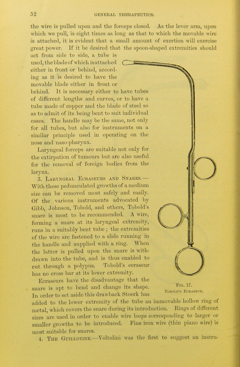 the wire is pulled upon and the forceps closed. As the lever arm, upon which we pixll, is eight times as long as that to which the movable wire is attached, it is evident that a small amount of exertion will exercise great power. If it he desired that the spoon-shaped extremities should act from side to side, a tube is used, the blade of which is attached either in front or behind, accord- ing as it is desired to have the movable blade either in front or behind. It is necessary either to have tubes of different lengths and curves, or to have a tube made of copper and the blade of steel so as to admit of its being bent to siiit individual cases. The handle may be the same, not only for all tubes, but also for instruments on a similar principle iised in operating on the nose and naso-pharynx. Laryngeal forceps are suitable not only for the extirpation of tumours but are also useful for the removal of foreign bodies from the larynx. 3. Laryngeal Ecraseurs and Snares.— With these pedunculated growths of a medium size can be removed most safely and easily. Of the various instruments advocated by Gibb, .Johnson, Tobold, and others, Tobold's snare is most to be recommended. A wire, forming a snare at its laryngeal extremity, runs in a suitably bent tube ; the extremities of the wire are fastened to a slide running in the handle and supplied with a ring. When the latter is pulled upon the snare is with- drawn into the tube, and is thus enabled to cut through a polypus. Tobold's ecraseur has no cross bar at its lower extremity. Ecraseurs have the disadvantage that the snare is apt to bend and change its shape. In order to set aside this drawback Stoerk has added to the lower extremity of the tube an immovable hollow ring of metal, which covers the snare during its introduction. Rings of different sizes are used in order to enable wire loops corresponding to larger or smaller growths to be introduced. Fine iron wire (thin piano wire) is most suitable for snares. 4. The Guillotine.—Voltolini was the first to suggest an instru- FiG. 17. Tobold's Ecraseur.