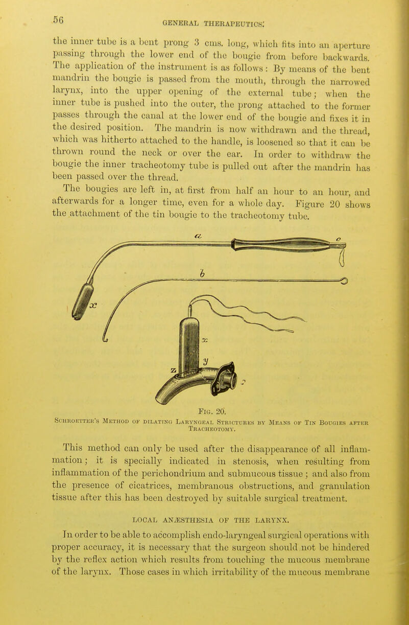 GENEHAL THERAPEUTICS: the inner tube ia a bent prong 3 cms. long, which tits into an aperture passing through the lower end of tlie bougie from before backwards. Tiie application of tlie instrument is as follows: By means of the bent mandrin the bougie is passed from the mouth, through the narrowed larynx, into the upper opening of the external tube; when the inner tube is pushed into the outer, the prong attached to the former passes tln-ough the canal at the lower end of the bougie and fixes it in the desired position. Ti^c mandrin is now withdrawn and the thread, wliich was hitherto attached to the handle, is loosened so that it can be thrown round the neck or over the ear. In order to withdraw the bougie the inner tracheotomy tube is pulled out after the mandrin has been passed over the thread. The bougies are left in, at first from half an hour to an hour, and afterwards for a longer time, even for a whole day. Figure 20 shows the attachment of the tin bougie to the tracheotomy tube. This method can only be used after the disappearance of all inflam- mation ; it is specially indicated in stenosis, when resulting from inflammation of the perichondriimi and submucous tissue ; and also from the presence of cicatrices, membranous obstructions, and gi'amüation tissue after this has been destroyed by suitable siu-gical treatment. LOCAL ANiESTHESIA OF THE LARYNX. In order to be able to accomplish endo-laryngeal surgical operations Avith proper accui-acy, it is necessar}' that the surgeou should not be hindered by the reflex action which results from touching the miicous membrane of the larynx. Those cases in which irritability of the mucous membrane