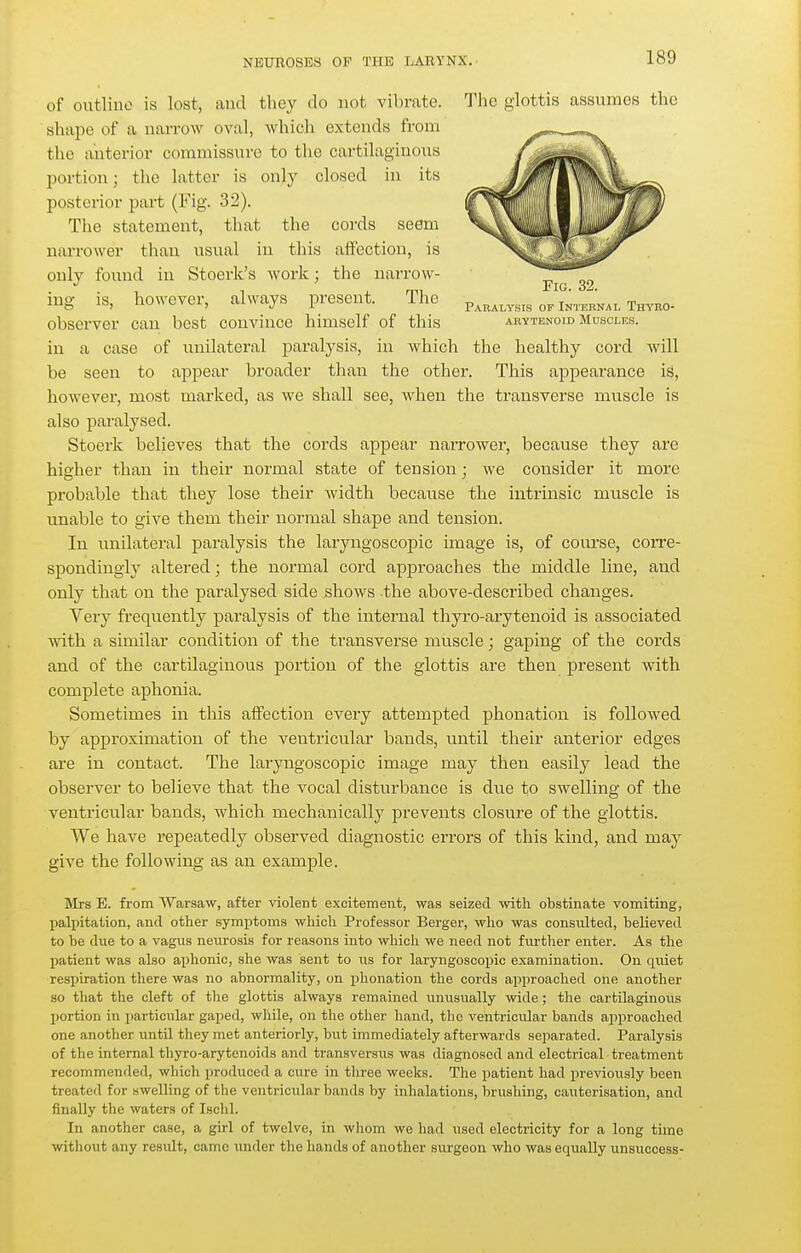 of outline is lost, and they do not vibrate. The glottis assumes the shape of a narrow oval, Avhich extends from the anterior commissure to the cartilaginous portion; the latter is only closed in its posterior part (Fig. 32). The statement, that the cords seem narrower than usual in this affection, is only found in Stoerk's work; the narrow- ing is, however, always present. Tlie p^«,,^,.«« of7ntkrnai. Tmno- observer can best convince himself of this arytenoid Muscles. in a case of unilateral paralysis, in which the healthy cord will be seen to appear broader than the other. This appearance is, however, most marked, as we shall see, when the transverse muscle is also paralysed. Stoerk believes that the cords appear narrower, because they are higher than in their normal state of tension; we consider it more probable that they lose their Avidth because the intrinsic muscle is unable to give them their normal shape and tension. In unilateral paralysis the laryngoscojsic image is, of course, coiTe- spondingiy altered; the normal cord approaches the middle line, and only that on the paralysed side shows -the above-described changes. Very frequently paralysis of the internal thyro-arytenoid is associated with a similar condition of the transverse muscle; gaping of the cords and of the cartilaginous portion of the glottis are then present with complete aphonia. Sometimes in this affection every attempted phonation is foUoAved by approximation of the ventricular bands, until their anterior edges are in contact. The laryngoscopic image may then easily lead the observer to believe that the vocal disturbance is due to swelling of the ventricular bands, which mechanically prevents closure of the glottis. We have repeatedly observed diagnostic errors of this kind, and may giA'^e the following as an example. Sirs E. from Warsaw, after violent excitement, was seized Avitli obstinate vomiting, palpitation, and other symptoms which Professor Berger, who was consulted, believed to be due to a vagus neurosis for reasons into which we need not further enter. As the patient was also aphonic, she was sent to us for laryngoscopic examination. On quiet respiration there was no abnormality, on i^honation the cords approached one another so that the cleft of tlie glottis always remained unusually wide; the cartilaginoiis portion in particular gaped, while, on the other hand, the ventricular bands approached one another until they met anteriorly, but immediately afterwards separated. Paralysis of the internal thyro-arytenoids and transversus was diagnosed and electrical treatment recommended, which produced a cure in three weeks. The patient had previously been treated for swelling of the ventricular bands by inhalations, brushing, cauterisation, and finally the waters of Isclil. In another case, a girl of twelve, in wliom we had used electricity for a long time without any resvilt, came under the hands of another surgeon who was equally unsuocess-