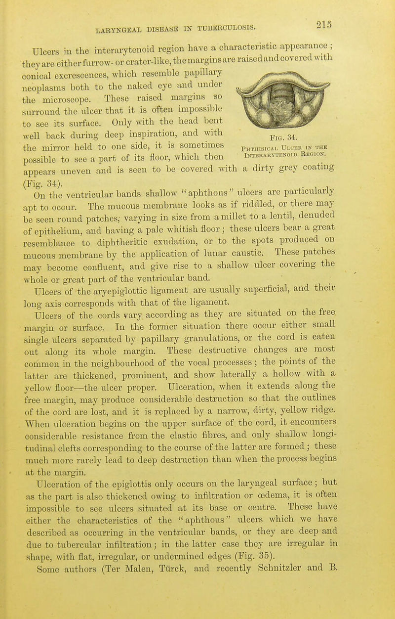 Ulcers in the interarytcnoid region have a characteristic appearance ; theyare eitherfurrow-or cratcr-like.themarginsare raiscdaudcovered with conical excrescences, which resemble papillary neoplasms both to the naked eye and nnder the microscope. These raised margins so surronnd the nicer that it is often impossn)lc to see its surface. Only with the head bent well back during deep inspiration, and with the mirror held to one side, it is sometimes ph.„„s,cau Uixer in the possible to see a part of its floor, which then iNx^ARvrEKom Reoion. appears uneven and is seen to be covered with a dirty grey coatmg (Fig. 34). . ^ ^ On the ventricular bands shallow aphthous ulcers are particularly apt to occur. The mucous membrane looks as if riddled, or there may be seen round patches, varying in size from a millet to a lentil, denuded of epithelium, and having a pale whitish floor; these ulcers bear a great resemblance to diphtheritic exudation, or to the spots produced on mucous membrane by the application of lunar caustic. These patches may become confluent, and give rise to a shallow ulcer covering the whole or great part of the ventricular band. Ulcers of the aryepiglottic ligament are usually superficial, and their long axis corresponds with that of the ligament. Ulcers of the cords vary according as they are situated on the free margin or surface. In the former situation there occur either small single ulcers separated by papillary granulations, or the cord is eaten out along its whole margin. These destructive changes are most common in the neighbom'hood of the vocal processes; the points of the latter are thickened, prominent, and show laterally a hollow with a yellow floor—the ulcer proper. Ulceration, when it extends along the free margin, may produce considerable destruction so that the outlines of the cord are lost, and it is replaced by a narrow, dirty, yellow ridge. When ulceration begins on the upper surface of the cord, it encounters considerable resistance from the elastic fibres, and only shallow longi- tudinal clefts corresponding to the course of the latter are formed; these much more rarely lead to deep destruction than when the process begins at the margin. Ulceration of the epiglottis only occurs on the laryngeal surface; but as the part is also thickened owing to infiltration or oedema, it is often impossible to see ulcers situated at its base or centre. These have either the characteristics of the aphthous ulcers which we have described as occurring in the ventricular bands, or they are deep and due to tubercular infiltration; in the latter case they are irregular in shape, with flat, irregular, or undermined edges (Fig. .35). Some authors (Ter Malen, Türck, and recently Schnitzler and B.