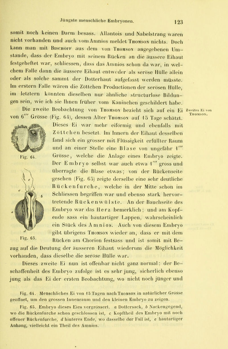 somit noch keinen Darm besass. Allanlois und Nabelstrang waren nicht vorhanden und auch vomAmnios meldet Thomson nichts. Doch kann man mit Bischoff aus dem von Thomson angegebenen Um- stände, dass der Embryo mit seinem Hücken an die äussere Eihaut festgeheftet war, schliessen, dass das Amnios schon da war, in wel- chem Falle dann die äussere Eihaut entweder als seröse Hülle allein oder als solche sammt der Dotterhaut aufgefasst werden müsste. Im erstem Falle wären die Zöttchen Productionen der serösen Illille, im letztern könnten dieselben nur ähnliche structurlose Bildun- gen sein, wie ich sie Ihnen früher vom Kaninchen geschildert habe. Die zweite Beobachtung von Thomson bezieht sich auf ein Ei von 6' Grösse (Fig. 64), dessen Alter Thomson auf 15 Tage schätzt. Dieses Ei war mehr eiförmig und ebenfalls mit Zöttchen besetzt. Im Innern der Eihaut desselben fand sich ein grosser mit Flüssigkeit erfüllter Raum und an einer Stelle eine Blase von ungefähr 1' Grösse, welche die Anlage eines Embryo zeigte. Der Embryo selbst war auch etwa 1' gross und überragte die Blase etwas; von der Rückenseite gesehen (Fig. 65) zeigte derselbe eine sehr deutliche Rücken furche, welche in der Mitte schon im Schliessen begriffen war und ebenso stark hervor- tretende Rücken Wülste. An der Bauchseite des Embryo war das Herz bemerklich; und am Kopf- ende sass ein hautartiger Lappen, wahrscheinlich ein Stück des Amnios. Auch von diesem Embryo gibt übrigens Thomson wieder an, dass er mit dem Rücken am Chorion festsass und ist somit mit Be- zug auf die Deutung der äusseren Eihaut wiederum die Möglichkeit vorhanden, dass dieselbe die seröse Hülle war. Dieses zweite Ei nun ist offenbar nicht ganz normal; der Be- schaffenheit des Embryo zufolge ist es sehr jung, sicherlich ebenso jung als das Ei der ersten Beobachtung, wo nicht noch jünger und Zweites Ei von THOM80N. Fig. 64. Menschliches Ei von 15 Tagen nach Thomson in natürlicher Grösse geölinet, um den grossen Innenraiim und den kleinen Embryo zu zeigen. Fig. 65. Embryo dieses Eies vergrössert. a Dottersack, b Nackengegend, wo die Riickenfurche schon geschlossen ist, c Kopftheil des Embryo mit noch offener Riickenfurche, d hinteres Ende, wo dasselbe der Fall ist, e hautartiger Anhang, vielleicht ein Theil des Amnios.