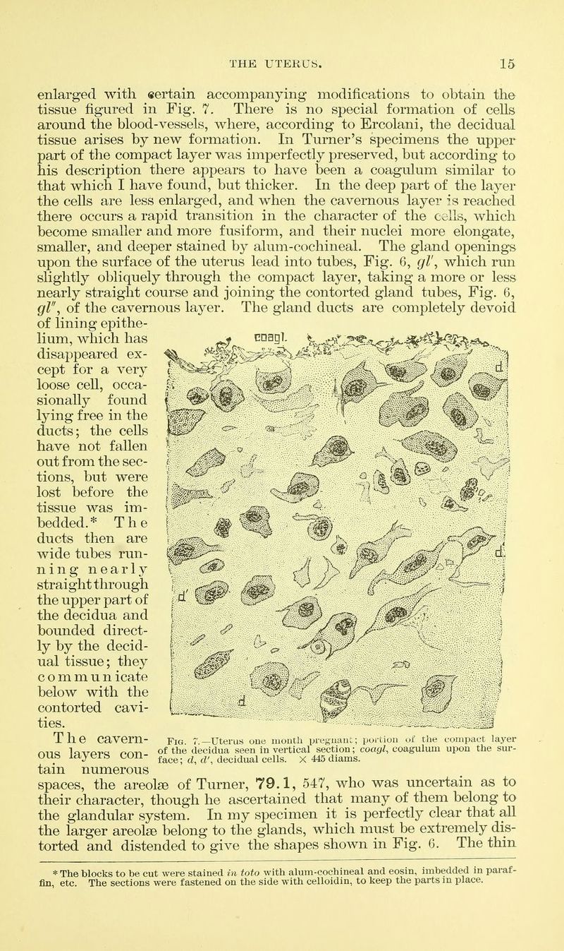 enlarged with eertain accompanying modifications to obtain the tissue figured in Fig. 7. There is no special formation of cells around the blood-vessels, where, according to Ercolani, the decidual tissue arises by new formation. In Turner's specimens the upper part of the compact layer was imperfectly preserved, but according to his description there appears to have been a coagulum similar to that which I have found, but thicker. In the deep part of the layer the cells are less enlarged, and when the cavernous layer is reached, there occurs a rapid transition in the character of the cells, which become smaller and more fusiform, and their nuclei more elongate, smaller, and deeper stained by alum-cochineal. The gland openings upon the surface of the uterus lead into tubes. Fig. 6, gZ', which run slightly obliquely through the compact layer, taking a more or less nearly straight course and joining the contorted gland tubes. Fig. 6, gl\ of the cavernous layer. The gland ducts are completely devoid of lining epithe- lium, which has cnag]. '^^^^^.f '^T-^^'f-^^^^'^y^A'^ . disappeared ex- cept for a very loose cell, occa- sionally found lying free in the ducts; the cells have not fallen out from the sec- tions, but were lost before the tissue was im- bedded.* The ducts then are wide tubes run- ning nearly straight through the upper part of the decidua and bounded direct- ly by the decid- ual tissue; they c o m m u n icate below with the contorted cavi- ties. _ . .__J The cavern- Fig. r.—uterus cue mouth iji-eguaut; pui-tiou or the coiiipcict layer rkn« la^m-pd onn of the decidua seen in vertical section; coagl, coagulum upon the sur- uute la^eib cun- face; d, d', decidual cells, x 445 diams. tain numerous spaces, the areolge of Turner, 79.1, 547, who was uncertain as to their character, though he ascertained that many of them belong to the glandular system. In my specimen it is perfectly clear that all the larger areolae belong to the glands, which must be extremely dis- torted and distended to give the shapes shown in Fig. 6. The thin * The blocks to be cut were stained in toto with alum-cochineal and eosin, imbedded in paraf- fin, etc. The sections were fastened on the side with celloidin, to keep the parts m place.