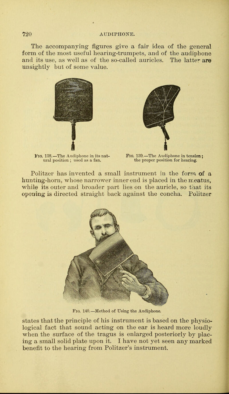 The accompanying figures give a fair idea of the general form of the most useful hearing-trumpets, and of the audiphone and its use, as well as of the so-called auricles. The latter are unsightly but of some value. Fig. 138.—The Audiphone in its nat- FiG. 139,—The Audiphone in tension; ural position ; used as a fan. the proper position for hearing. Politzer has invented a small instrument in the form of a hunting-horn, whose narrower inner end is placed in the rry.eatus, while its outer and broader part lies on the auricle, so that its opening is directed straight back against the concha. Politzer Fig. 140.—Method of Using the Audiphone. states that the principle of his instrument is based on the physio- logical fact that sound acting on the ear is heard more loudly when the surface of the tragus is enlarged posteriorly by plac- ing a small solid plate upon it. I have not yet seen any marked benefit to the hearing from Politzer's instrument.