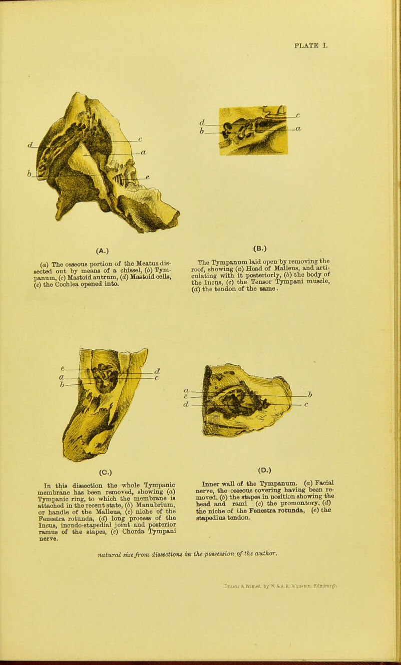 (A.) (a) The oaaeous portion of the Meatus dis- sected out by means of a chisael, (6) Tym- panum, (c) Mastoid autrom, (d) Mastoid cells, (e) the Cochlea opened into. (B.) The Tympanum laid open by removing the roof, showing (a) Head of MaUeus, and arti- culating with it posteriorly, (6) the body of the Incus, (c) the Tensor Tympani muscle, (d) the tendon of the same. In this dissection the whole Tympanic membrane has been removed, showing (a) Tympanic ring, to which the membrane is attached in the recent state, (b) Manubrium, or handle of the MjiUeus, (c) niche of the Fenestra rotunda, (cJ) long process of the Incus, incudo-stapedial joint and posterior ramus of the stapes, (e) Chorda Tympani nerve. (D.) Inner wall of the Tympanum, (a) Facial nerve, the osseous covering having been re- moved, (b) the stapes in position showing the head and rami (c) the promontoi-y, (<f) the niche of the Fenestra rotunda, (e) the stapedius tendon. natural sue from diisectums in the pomstion of the author. Drawn fcPritiieiL by W. SsA.K-JoTiii-lon, E<lmbiii-^i