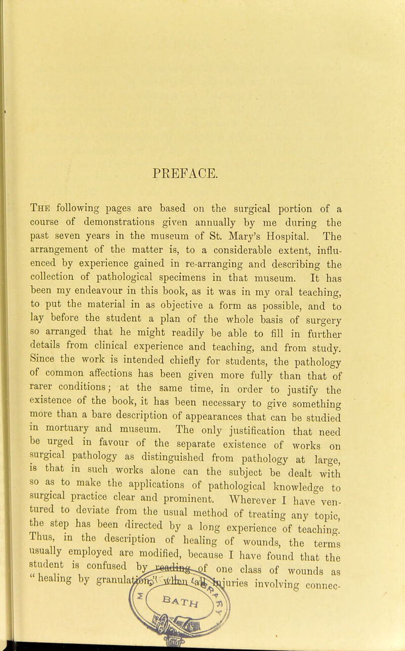 PREFACE. The following pages are based on the surgical portion of a course of demonstrations given annually by me during the past seven years in the museum of St. Mary's Hospital. The arrangement of the matter is, to a considerable extent, influ- enced by experience gained in re-arranging and describing the collection of pathological specimens in that museum. It has been my endeavour in this book, as it was in my oral teaching, to put the material in as objective a form as possible, and to lay before the student a plan of the whole basis of surgery so arranged that he might readily be able to fill in further details from clinical experience and teaching, and from study. Since the work is intended chiefly for students, the pathology of common affections has been given more fully than that of rarer conditions; at the same time, in order to justify the existence of the book, it has been necessary to give something more than a bare description of appearances that can be studied in mortuary and museum. The only justification that need be urged in favour of the separate existence of works on surgical pathology as distinguished from pathology at large, 18 that in such works alone can the subject be dealt with so as to make the applications of pathological knowledge to surgical practice clear and prominent. Wherever I have ven- tured to deviate from the usual method of treating any topic the step has been directed by a long experience of teaching Thus, in the description of healing of wounds, the terms usually employed are modified, because I have found that the student is confused bv^^adiag^ one class of wounds as healing by granulat^^^^^^ j^^^l^i ^^^^^^^