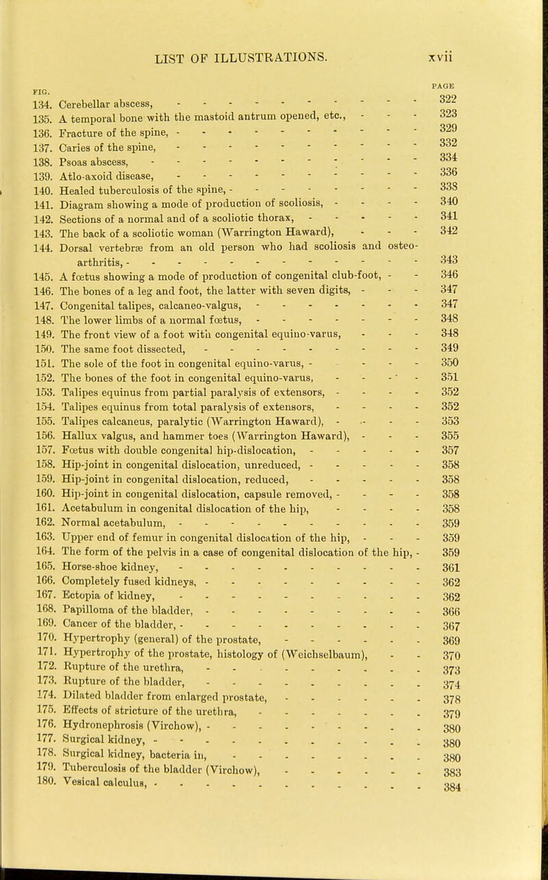 PAGE FIG. 134. Cerebellar abscess, ^2- 135. A temporal bone with the mastoid antrum opened, etc., - - - 323 136. Fracture of the spine, ^29 137. Caries of the spine, 332 138. Psoas abscess, - - - - 334 139. Atlo-axoid disease, 336 140. Healed tuberculosis of the spine, 338 141. Diagram showing a mode of production of scoliosis, - - - - 340 142. Sections of a normal and of a scoliotic thorax, 341 143. The back of a scoliotic woman (Warrington Haward), . - - 342 144. Dorsal vertebrse from an old person who had scoliosis and osteo- arthritis, 343 145. A fcetus showing a mode of production of congenital club-foot, - - 346 146. The bones of a leg and foot, the latter with seven digits, - - - 347 147. Congenital talipes, calcaneo-valgus, 347 148. The lower limbs of a normal foetus, ------- 348 149. The front view of a foot witli congenital equiuo-varus, - - - 348 150. The same foot dissected, 349 151. The sole of the foot in congenital equino-varus, 350 152. The bones of the foot in congenital equino-varus, - - - - 351 153. Talipes equinus from partial paralysis of extensors, - - - - 352 154. Talipes equinus from total paralysis of extensors, - - - . 352 155. Talipes calcaneus, paralytic (AVarrington Haward), 353 156. Hallux valgus, and hammer toes (Warrington Haward), - - - 355 157. Foetus with double congenita] hip-dislocation, ----- 357 158. Hip-joint in congenital dislocation, unreduced, 358 159. Hip-joint in congenital dislocation, reduced, 358 160. Hip-joint in congenital dislocation, capsule removed, - - - - 358 161. Acetabulum in congenital dislocation of the hip, - - . - 358 162. Normal acetabulum, - - - 359 163. Upper end of femur in congenital dislocation of the hip, - - - 359 164. The form of the pelvis in a case of congenital dislocation of the hip, - 359 165. Horse-shoe kidney, 361 166. Completely fused kidneys, 362 167. Ectopia of kidney, 362 168. Papilloma of the bladder, 36B 169. Cancer of the bladder, 367 170. Hypertrophy (general) of the prostate, 369 171. Hypertrophy of the prostate, histology of (Weichselbaum), - - 370 172. Rupture of the urethra, 373 173. Rupture of the bladder, 374 174. Dilated bladder from enlarged prostate, 378 175. Effects of stricture of the urethra, 379 176. Hydronephrosis (Virchow), - - . . 38O 177. Surgical kidney, - - . ggg 178. Surgical kidney, bacteria in, 380 179. Tuberculosis of the bladder (Virchow), 383 180. Vesical calculus, gg^