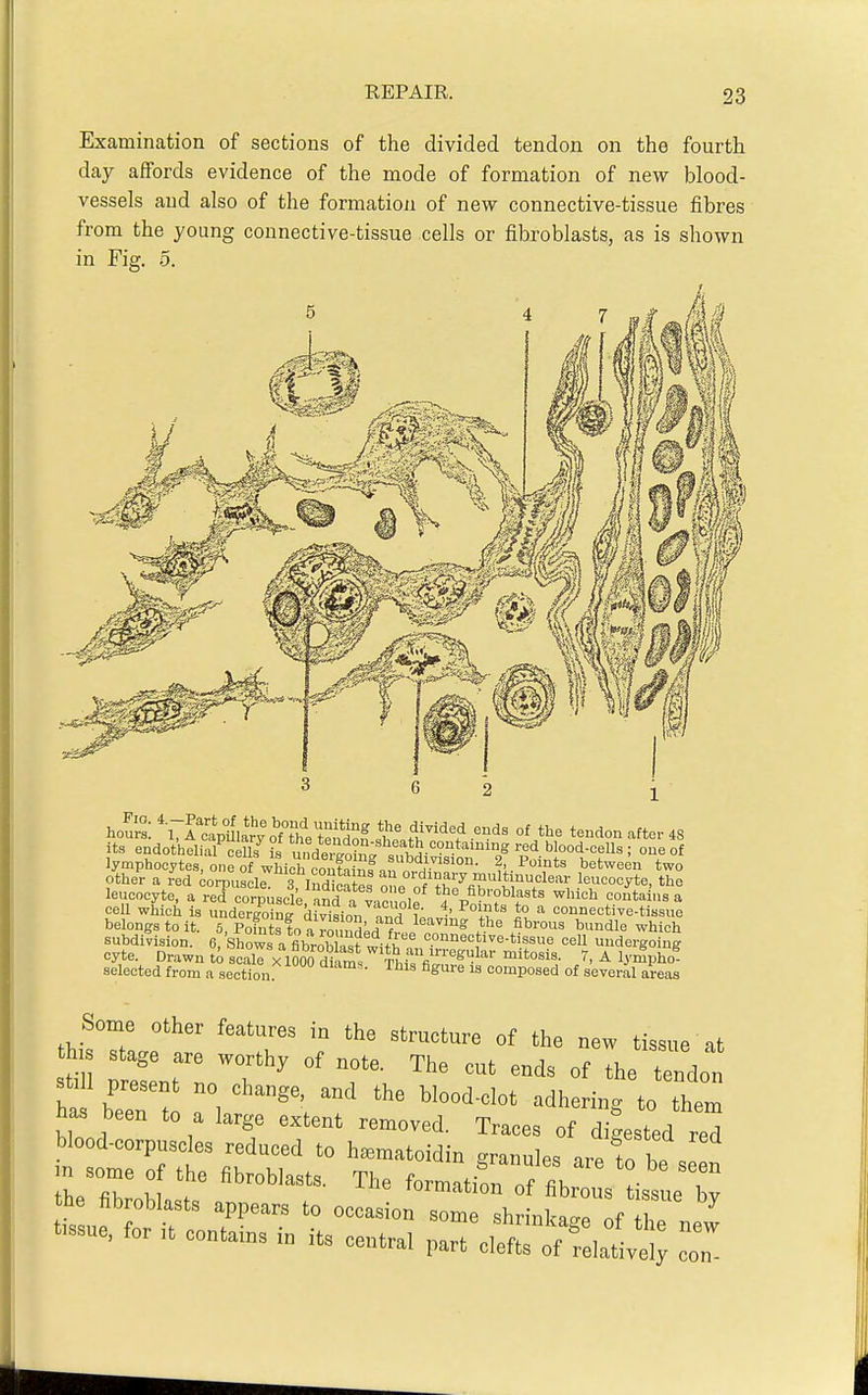 Examination of sections of the divided tendon on the fourth day affords evidence of the mode of formation of new blood- vessels and also of the formation of new connective-tissue fibres from the young connective-tissue cells or fibroblasts, as is shown in Fig. 5. hour: %7i'c4ma\'y%m'eS swfh'^'f 'J''' -or 48 it. endothelial cells is nnd!^</a^Z^,^^^^^ blood-cells; one of lymphocytes, one of wLh 3 nf'^^^^^^^^^ ^ - between two other a red corpusck 3 TnHinnSf ordinary multmuclear leucocyte, the leucocyte, a red corpuscle nndnv,^,^ the fibroblasts which conta .is a cell which is unde/ii^ri dMsion ?■ ^' ^T.^ ^ '^ connective-tissue belongs to it. 5, Points to a rmmH^rf^ leaving the fibrous bundle which subdivision. 6, Shows a fibrnh  connective-tissue cell undergoing cyte. Drawn to scall x iKam* Thfc,'V ^' ^ Ij'^ho? selected from a section '^^'''^ composed of several areas Some other features in the structure of the new tissue at th.s stage are worthy of note. The cut ends of the tendot i-n -LUC uuij enas oi the tendnn st,ll present no change, and the blood-clot adheri„rt„ tl™ ha« been to a large extent renaovcd. Traces of d Lsted red blood-corpuscles reduced to h^matoidin granules are to be se^n m some „ the fibroblasts. The formatbn of fibrous iss .e bv the fibroblasts appears to occasion some shrinkarnf Z „ '-ue, for it contains in its central part Cef::'of re,,:iv!;; coT