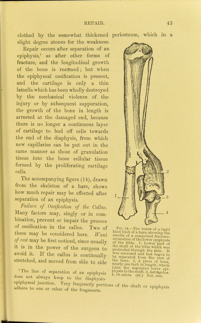 clothed by the somewhat thickened slight degree atones for the weakness. Eepair occurs after separation of an epiphysis/ as after other forms of fracture, and the longitudinal growth of the bone is resumed; but when the epiphyseal ossification is present, and the cartilage is only a thin lamella which has been wholly destroyed by the mechanical violence of the injury or by subsequent suppuration, the growth of the bone in length is arrested at the damaged end, because there is no longer a continuous layer of cartilage to bud off cells towards the end of the diaphysis, from which new capillaries can be put out in the same manner as those of granulation tissue into the loose cellular tissue formed by the proliferating cartilage cells. The accompanying figure (14), drawn from the skeleton of a hare, shows how much repair may be effected after separation of an epiphysis. Failure of Ossification of the Callus. Many factors may, singly or in com- bination, prevent or impair the process of ossification in the callus. Two of these may be considered here. J^Fant of rest may be first noticed, since usually it is in the power of the surgeon to avoid it. If the callus is continually stretched, and moved from side to side 'The line of separation of an epiphysis does not always keep to the diaphysio- epiphyseal junction. Very frequently portion adhere to one or other of the fragments. periosteum, which in a Fio. u.—The bones of a riglit hiud limb of a hare, sliowing the results of a compound fracturo- .separation of the lower opipliysis of the tibia. 1, Lower part of the shaft of the tibia which was protruded through the skin It was necrosed and had begun to be separated from the rest of the bone. 2, A piece of bono, nearly one inch in length, which joins the separated lower epi- physis to the shaft. 3, AstrSigaliis 4, Us calcis. (40.) Nat. size s of the shaft or epiphysis