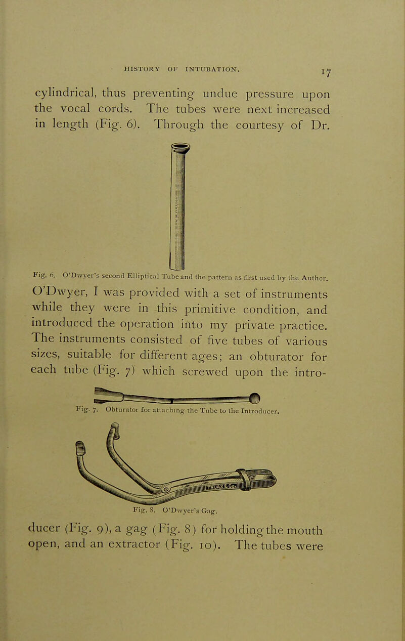 cylindrical, thus preventing undue pressure upon the vocal cords. The tubes were next increased in length (Fig. 6). Through the courtesy of Dr. m '' i'l \\ L Fig. 6. O'Dwyer s second Elliptical Tube and tlie pattern as first used by the Author. O'Dwyer, I was provided with a set of instruments while they were in this primitive condition, and introduced the operation into my private practice. The instruments consisted of five tubes of various sizes, suitable for different ages; an obturator for each tube (Fig. 7) which screwed upon the intro- Fig. 7. Obturator for attaching the Tube to the Introducer. l<isr. S. O'Dwyer's Gng. ducer (Fig. 9), a gag (Fig. 8) for holding the mouth open, and an extractor (Fig. 10). The tubes were