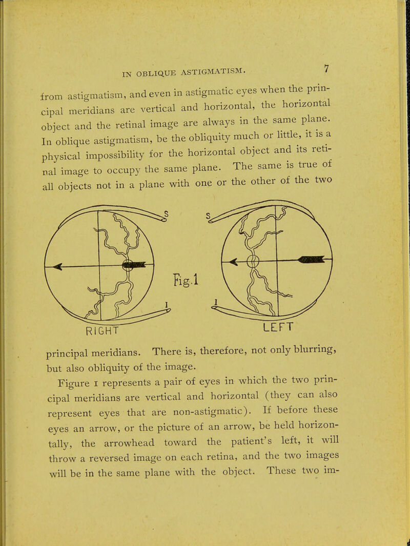 from astigmatism, and even in astigmatic eyes when the prin- cipal meridians are vertical and horizontal, the horizontal object and the retinal image are always in the same plane. In oblique astigmatism, be the obhquity much or little, it is a physical impossibility for the horizontal object and its reti- nal image to occupy the same plane. The same is true of all objects not in a plane with one or the other of the two RIGHT LEFT principal meridians. There is, therefore, not only blurring, but also obliquity of the image. Figure i represents a pair of eyes in which the two prin- cipal meridians are vertical and horizontal (they can also represent eyes that are non-astigmatic). If before these eyes an arrow, or the picture of an arrow, be held horizon- tally, the arrowhead toward the patient's left, it will throw a reversed image on each retina, and the two images will be in the same plane with the object. These two im-