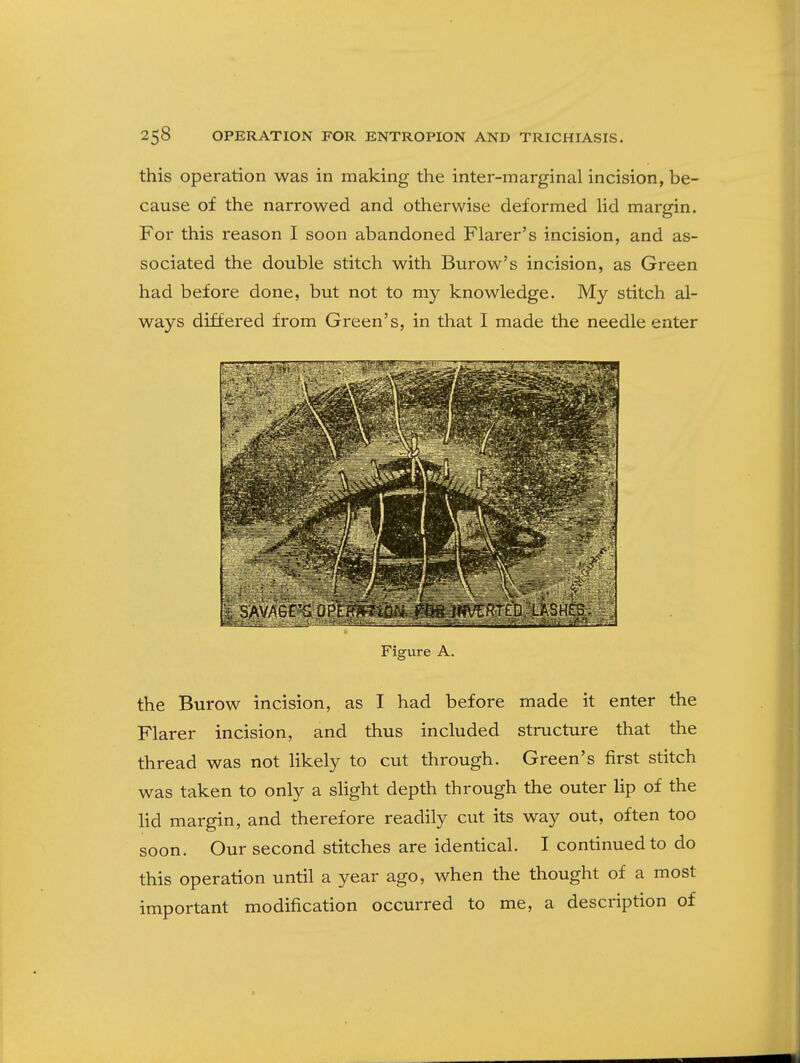 this operation was in making the inter-marginal incision, be- cause of the narrowed and otherwise deformed lid margin. For this reason I soon abandoned Flarer's incision, and as- sociated the double stitch with Burow's incision, as Green had before done, but not to my knowledge. My stitch al- ways differed from Green's, in that I made the needle enter Figure A. the Burow incision, as I had before made it enter the Flarer incision, and thus included structure that the thread was not likely to cut through. Green's first stitch was taken to only a slight depth through the outer lip of the lid margin, and therefore readily cut its way out, often too soon. Our second stitches are identical. I continued to do this operation until a year ago, when the thought of a most important modification occurred to me, a description of