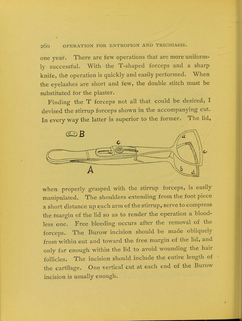 one year. There are few operations that are more uniform- ly successful. With the T-shaped forceps and a sharp knife, the operation is quickly and easily performed. When the eyelashes are short and few, the double stitch must be substituted for the plaster. Finding the T forceps not all that could be desired, I devised the stirrup forceps shown in the accompanying cut. In every way the latter is superior to the former. The lid. when properly grasped with the stirrup forceps, is easily manipulated. The shoulders extending from the foot piece a short distance up each arm of the stirrup, serve to compress the margin of the lid so as to render the operation a blood- less one. Free bleeding occurs after the removal of the forceps. The Burow incision should be made obliquely from within out and toward the free margin of the lid, and only far enough within the lid to avoid wounding the hair follicles. The incision should include the entire length of the cartilage. One vertical cut at each end of the Burow incision is usually enough.