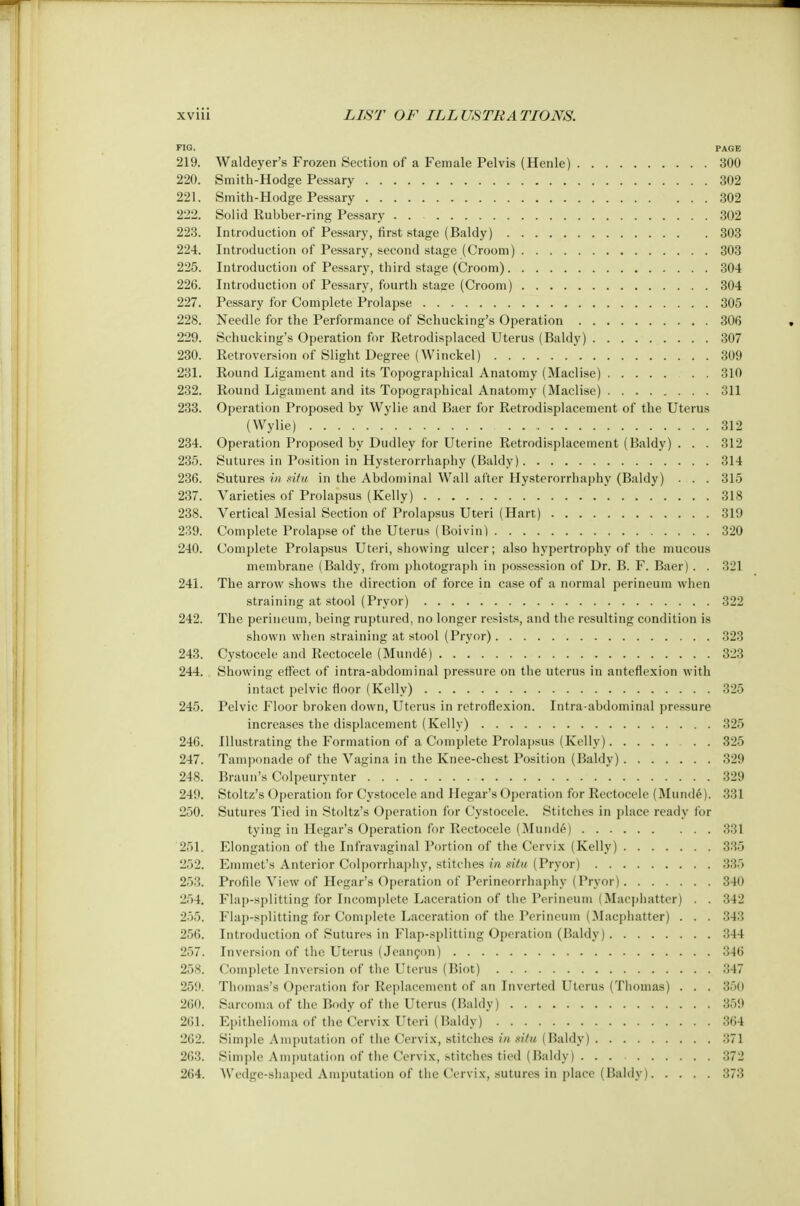 FIG. PAGE 219. Waldeyer's Frozen Section of a Female Pelvis (Henle) 300 220. Smith-Hodge Pessary 302 221. Smith-Hodge Pessary 302 222. Solid Rubber-ring Pessary . . 302 223. Introduction of Pessary, first stage (Baldy) 303 224. Introduction of Pessary, second stage (Groom) 303 225. Introduction of Pessary, third stage (Croom) 304 226. Introduction of Pessary, fourth stasre (Croom) 304 227. Pessary for Complete Prolapse 305 228. Needle for the Performance of Schucking's Operation 306 229. Schucking's Operation for Retrodisplaced Uterus (Baldy) 307 230. Retroversion of Slight Degree (Winckel) 309 231. Round Ligament and its Topographical Anatomy (Maclise) 310 232. Round Ligament and its Topographical Anatomy (Maclise) 311 233. Operation Proposed by Wylie and Baer for Retrodisplacement of the Uterus (Wylie) 312 234. Operation Proposed by Dudley for Uterine Retrodisplacement (Baldy) . . . 312 235. Sutures in Position in Hysterorrhaphy (Baldy) 314 236. Sutures in situ in the Abdominal Wall after Hysterorrhaphy (Baldy) . . . 315 237. Varieties of Prolapsus (Kelly) 318 238. Vertical Mesial Section of Prolapsus Uteri (Hart) 319 239. Complete Prolapse of the Uterus (Boivin) 320 240. Complete Prolapsus Uteri, showing ulcer; also hypertrophy of the mucous membrane (Baldy, from photograph in possession of Dr. B. F. Baer) . . 321 241. The arrow shows the direction of force in case of a normal perineum when straining at stool (Pryor) 322 242. The perineum, being ruptured, no longer resists, and the resulting condition is shown when straining at stool (Pryor) 323 243. Cystocele and Rectocele (Minute) 323 244. Showing effect of intra-abdominal pressure on the uterus in anteflexion with intact pelvic floor (Kelly) 325 245. Pelvic Floor broken down, Uterus in retroflexion. Intra-abdominal pressure increases the displacement (Kelly) 325 246. Illustrating the Formation of a Complete Prolapsus (Kelly) . . 325 247. Tamponade of the Vagina in the Knee-chest Position (Baldy) 329 248. Braun's Colpeurynter 329 249. Stoltz's Operation for Cystocele and Hegar's Operation for Rectocele (Munde). 331 250. Sutures Tied in Stoltz's Operation for Cystocele. Stitches in place ready lor tying in Hegar's Operation for Rectocele (Munde) 331 251. Elongation of the Infravaginal Portion of the Cervix (Kelly) 335 252. Emmet's Anterior Colporrhaphy, stitches in situ (Pryor) 335 253. Profile View of Hegar's Operation of Perineorrhaphy (Pryor) 340 254. Flap-splitting for Incomplete Laceration of the Perineum (Maephatter) . . 342 255. Flap-splitting for Complete Laceration of the Perineum (Maephatter) . . . 343 256. Introduction of Sutures in Flap-splitting Operation (Baldy) 344 257. Inversion of the Uterus (Jeancon) 346 258. Complete Inversion of the Uterus (Biot) 347 259. Thomas's Operation for Replacement of an Inverted Uterus (Thomas) . . . 350 260. Sarcoma of the Body of the Uterus (Baldy) 359 261. Epithelioma of the Cervix Uteri (Baldy) 364 262. Simple Amputation of the Cervix, stitches in situ (Baldy) 371 263. Simple Amputation of the Cervix, stitches tied (Baldy) 372 264. Wedge-shaped Amputation of the Cervix, sutures in place (Baldy) 373