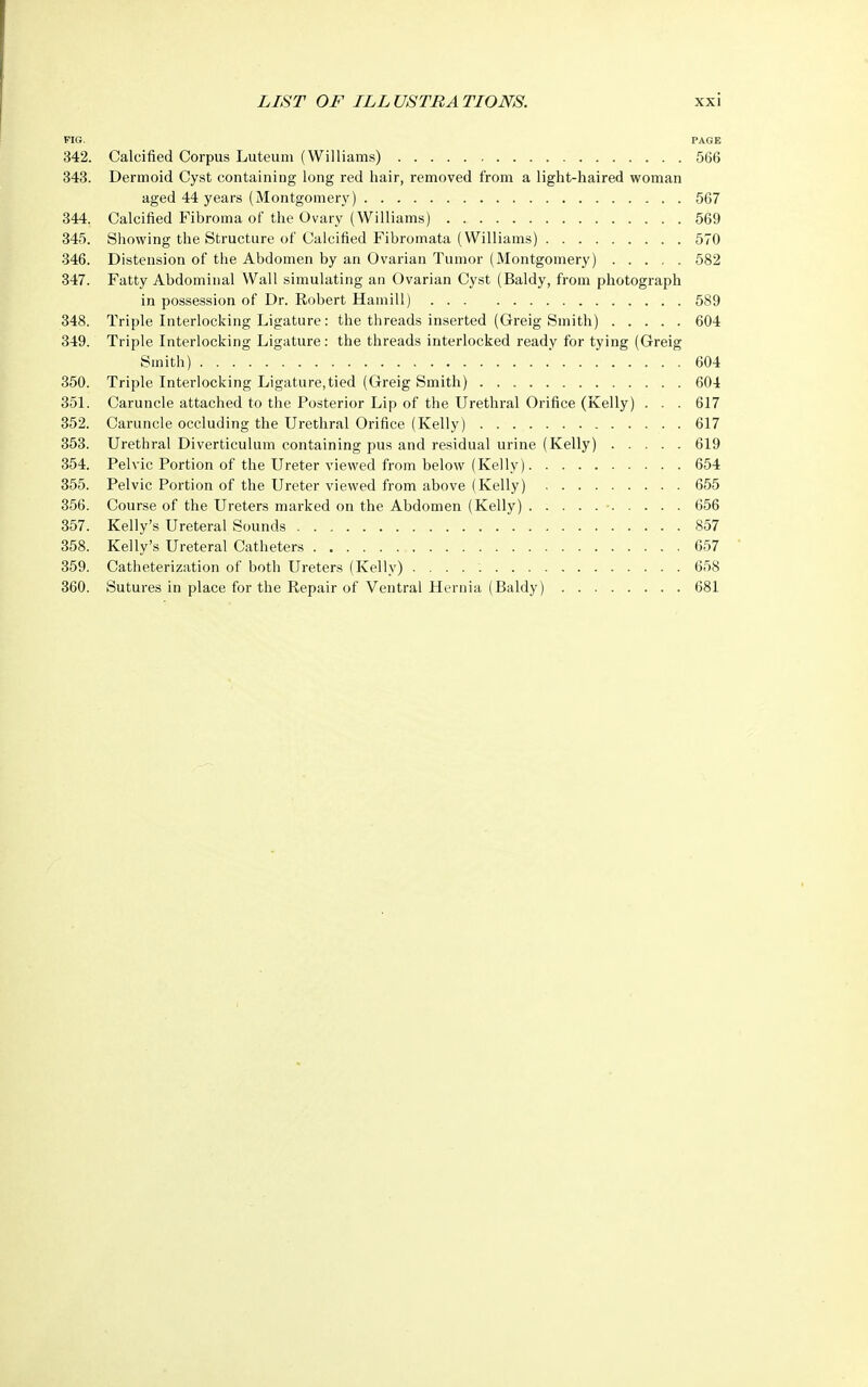FIG. PAGE 342. Calcified Corpus Luteuin (Williams) 566 343. Dermoid Cyst containing long red hair, removed from a light-haired woman aged 44 years (Montgomery) 567 344. Calcified Fibroma of the Ovary (Williams) 569 345. Showing the Structure of Calcified Fibromata (Williams) 570 346. Distension of the Abdomen by an Ovarian Tumor (Montgomery) 582 347. Fatty Abdominal Wall simulating an Ovarian Cyst (Baldy, from photograph in possession of Dr. Robert Hamill) 589 348. Triple Interlocking Ligature : the threads inserted (Greig Smith) 604 349. Triple Interlocking Ligature: the threads interlocked ready for tying (Greig Smith) 604 350. Triple Interlocking Ligature,tied (Greig Smith) 604 351. Caruncle attached to the Posterior Lip of the Urethral Orifice (Kelly) . . . 617 352. Caruncle occluding the Urethral Orifice (Kelly) 617 353. Urethral Diverticulum containing pus and residual urine (Kelly) 619 354. Pelvic Portion of the Ureter viewed from below (Kelly) 654 355. Pelvic Portion of the Ureter viewed from above (Kelly) 655 356. Course of the Ureters marked on the Abdomen (Kelly) • 656 357. Kelly's Ureteral Sounds 857 358. Kelly's Ureteral Catheters 657 359. Catheterization of both Ureters (Kelly) 658 360. Sutures in place for the Repair of Ventral Hernia (Baldy) 681