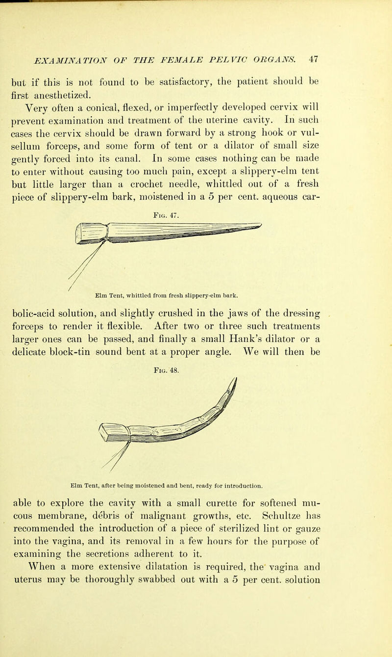 but if this is not found to be satisfactory, the patient should be first anesthetized. Very often a conical, flexed, or imperfectly developed cervix will prevent examination and treatment of the uterine cavity. In such cases the cervix should be drawn forward by a strong hook or vul- sellum forceps, and some form of tent or a dilator of small size gently forced into its canal. In some cases nothing can be made to enter without causing too much pain, except a slippery-elm tent but little larger than a crochet needle, whittled out of a fresh piece of slippery-elm bark, moistened in a 5 per cent, aqueous car- Fig. 47. Elm Tent, whittled from fresh slippery-elm bark. bolic-acid solution, and slightly crushed in the jaws of the dressing forceps to render it flexible. After two or three such treatments larger ones can be passed, and finally a small Hank's dilator or a delicate block-tin sound bent at a proper angle. We will then be Fig. 48. Elm Tent, after being moistened and bent, ready for introduction. able to explore the cavity with a small curette for softened mu- cous membrane, debris of malignant growths, etc. Schultze has recommended the introduction of a piece of sterilized lint or gauze into the vagina, and its removal in a few hours for the purpose of examining the secretions adherent to it. When a more extensive dilatation is required, the vagina and uterus may be thoroughly swabbed out with a 5 per cent, solution