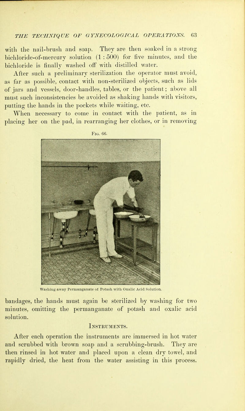 with the nail-brush and soap. They are then soaked in a strong bichloride-of-mercury solution (1 : 500) for five minutes, and the bichloride is finally washed off with distilled water. After such a preliminary sterilization the operator must avoid, as far as possible, contact with non-sterilized objects, such as lids of jars and vessels, door-handles, tables, or the patient; above all must such inconsistencies be avoided as shaking hands with visitors, putting the hands in the pockets while waiting, etc. When necessary to come in contact with the patient, as in placing her on the pad, in rearranging her clothes, or in removing Fig. 66. Washing away Permanganate ot Potash with Oxalic Acid Solution. bandages, the hands must again be sterilized by washing for two minutes, omitting the permanganate of potash and oxalic acid solution. Instruments. After each operation the instruments are immersed in hot water and scrubbed with brown soap and a scrubbing-brush. They are then rinsed in hot water and placed upon a clean dry towel, and rapidly dried, the heat from the water assisting in this process.