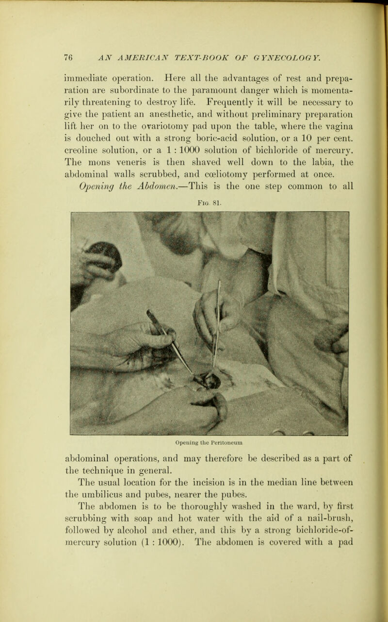 immediate operation. Here all the advantages of rest and prepa- ration are subordinate to the paramount danger which is momenta- rily threatening to destroy life. Frequently it will be necessary to give the patient an anesthetic, and without preliminary preparation lift her on to the ovariotomy pad upon the table, where the vagina is douched out with a strong boric-acid solution, or a 10 per cent, creoline solution, or a 1 : 1000 solution of bichloride of mercury. The mons veneris is then shaved well down to the labia, the abdominal walls scrubbed, and coeliotomy performed at once. Opening the Abdomen.—This is the one step common to all Fig 81 Opening the Peritoneum abdominal operations, and may therefore be described as a part of the technique in general. The usual location for the incision is in the median line between the umbilicus and pubes, nearer the pubes. The abdomen is to be thoroughly washed in the ward, by first scrubbing with soap and hot water with the aid of a nail-brush, followed by alcohol and ether, and this by a strong bichloride-of- mercury solution (1 : 1000). The abdomen is covered with a pad