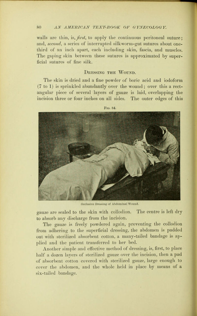 walls are thin, is,first, to apply the continuous peritoneal suture; and, second, a series of interrupted silkworm-gut sutures about one- third of an inch apart, each including skin, fascia, and muscles. The gaping skin between these sutures is approximated by super- ficial sutures of fine silk. Dressing the Wound. The skin is dried and a fine powder of boric acid and iodoform (7 to 1) is sprinkled abundantly over the wound; over this a rect- angular piece of several layers of gauze is laid, overlapping the incision three or four inches on all sides. The outer edges of this Fig. 84. Occlusive Dressing of Abdominal Wound. gauze are sealed to the skin with collodion. The centre is left dry to absorb any discharge from the incision. The gauze is freely powdered again, preventing the collodion from adhering to the superficial dressing, the abdomen is padded out with sterilized absorbent cotton, a many-tailed bandage is ap- plied and the patient transferred to her bed. Another simple and effective method of dressing, is, first, to place half a dozen layers of sterilized gauze over the incision, then a pad of absorbent cotton covered with sterilized gauze, large enough to cover the abdomen, and the whole held in place by means of a six-tailed bandage.