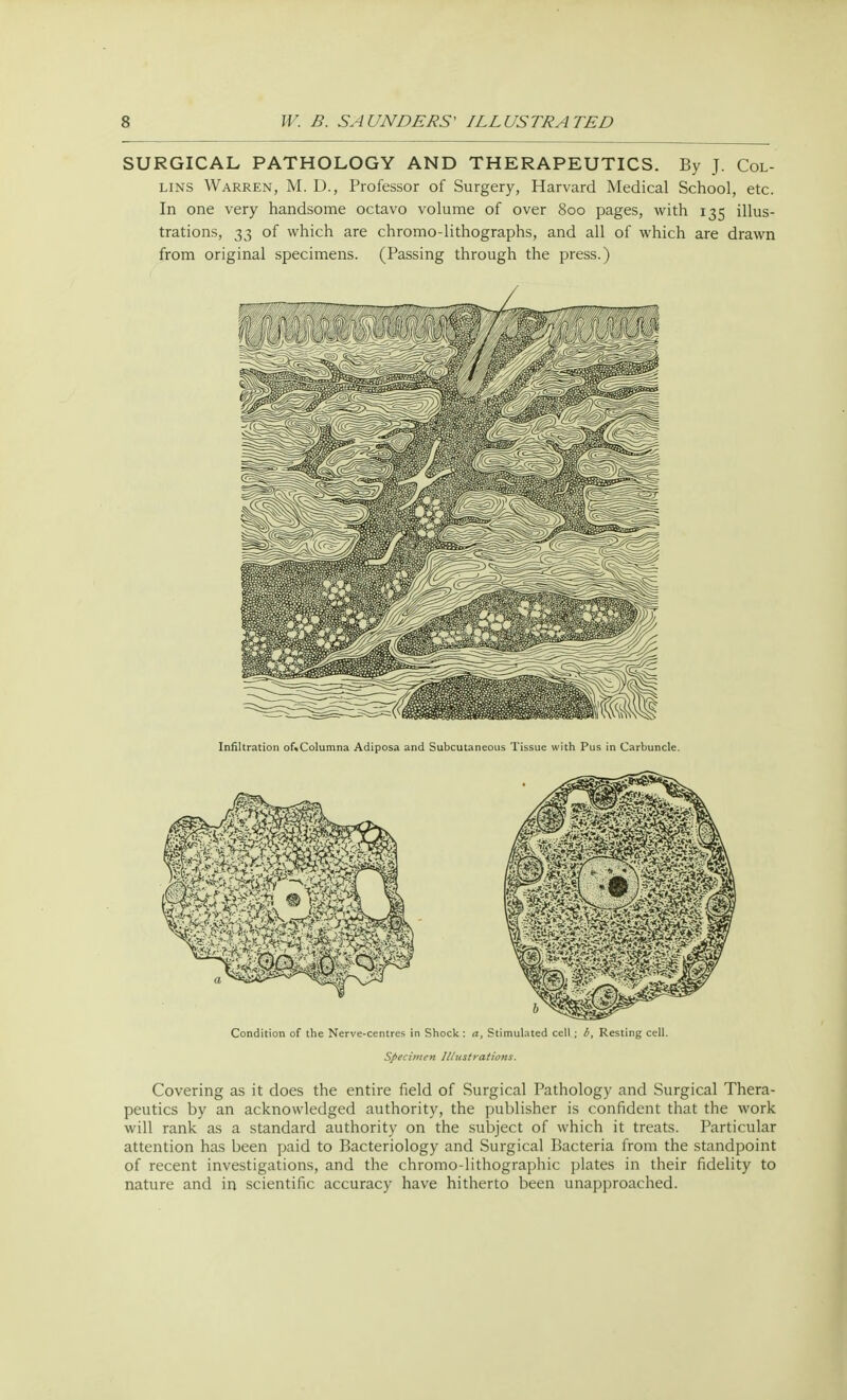 SURGICAL PATHOLOGY AND THERAPEUTICS. By J. Col- lins Warren, M. D., Professor of Surgery, Harvard Medical School, etc. In one very handsome octavo volume of over 800 pages, with 135 illus- trations, 33 of which are chromo-lithographs, and all of which are drawn from original specimens. (Passing through the press.) Infiltration of«Columna Adiposa and Subcutaneous Tissue with Pus in Carbuncle. Condition of the Nerve-centres in Shock: a, Stimulated cell ; b, Resting cell. Specimen Illustrations. Covering as it does the entire field of Surgical Pathology and Surgical Thera- peutics by an acknowledged authority, the publisher is confident that the work will rank as a standard authority on the subject of which it treats. Particular attention has been paid to Bacteriology and Surgical Bacteria from the standpoint of recent investigations, and the chromo-lithographic plates in their fidelity to nature and in scientific accuracy have hitherto been unapproached.