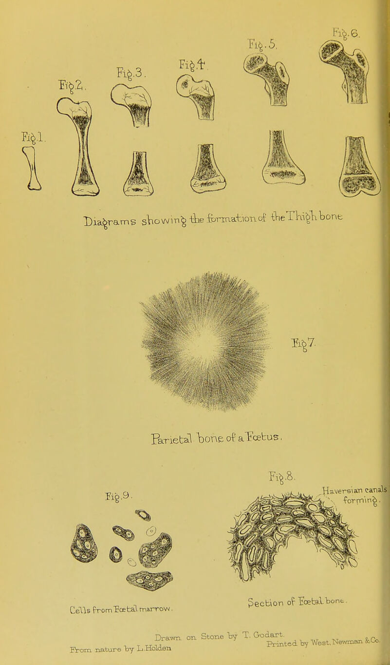 Parietal bone o-p aTcetus, Haversian canals ■forming. Cells (VomToetal-mjo-row. Section of Eoetalbont. Drawn oxi Stone by T. Grodart. ijiawn o y panted W West, Newmsn ^Co Erom nature by Li.tioiOBn