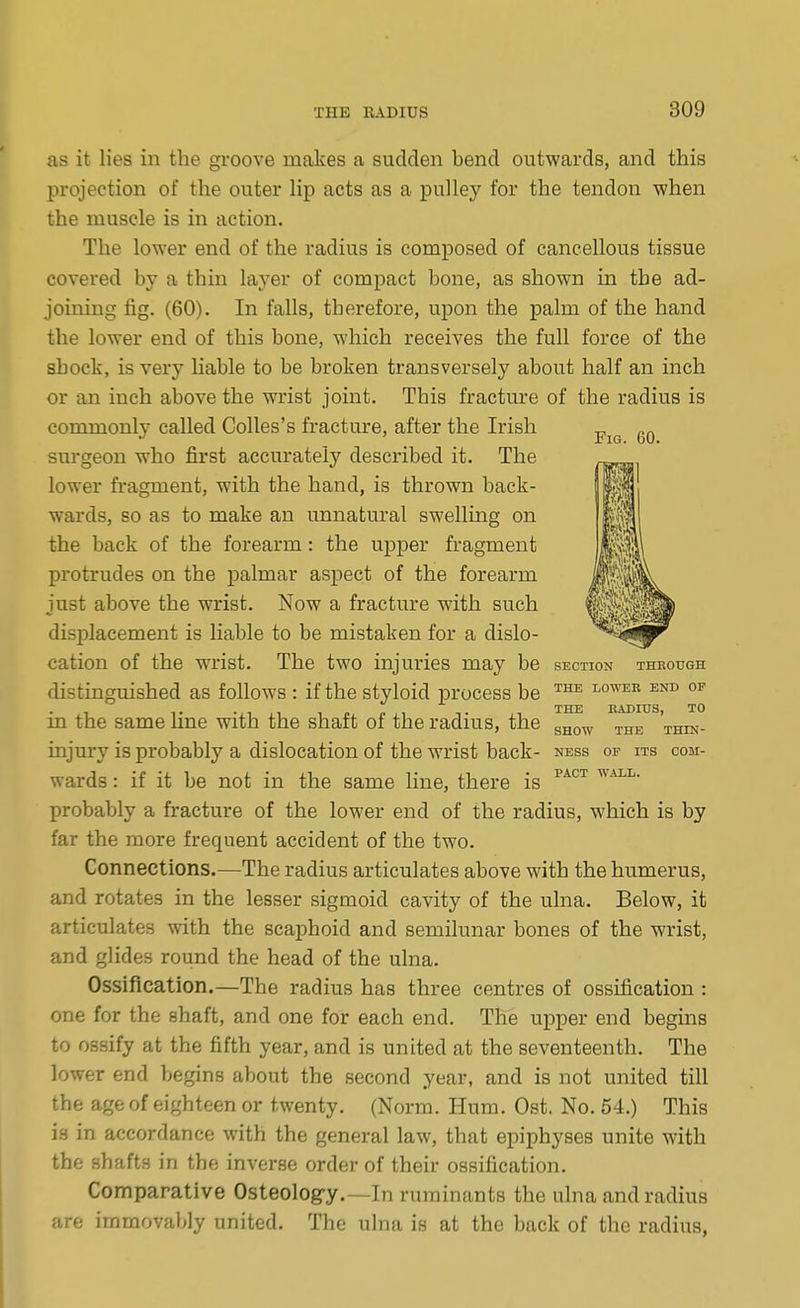 as it lies in the gi'oove makes a sudden bend outwards, and this projection of the outer lip acts as a pulley for the tendon when the muscle is in action. The lower end of the radius is composed of cancellous tissue covered by a thin layer of compact bone, as shown in the ad- joining fig. (60). In falls, therefore, ujjon the palm of the hand the lower end of this bone, which receives the full force of the shock, is very liable to be broken transversely about half an inch or an inch above the wrist joint. This fracture of the radius is commonly called Colles's fracture, after the Irish j,^^^ sm-geon who first accurately described it. The lower fo'agment, with the hand, is thrown back- wards, so as to make an unnatural swellmg on the back of the forearm: the u|)per fragment protrudes on the palmar aspect of the forearm just above the wrist. Now a fracture with such displacement is liable to be mistaken for a dislo- cation of the wrist. The two injuries may be section through distinguished as follows : if the styloid process be ™^ lower end of 1 !• -.1,1 11. n.i T ,1 THE RADIUS, TO m the same hne with the shaft oi the radius, the g^o^ ^.g^, ^hin- injury is probably a dislocation of the wrist back- ness of its com- wards: if it be not in the same line, there is probably a fracture of the lower end of the radius, which is by far the more frequent accident of the two. Connections.—The radius articulates above with the humerus, and rotates in the lesser sigmoid cavity of the ulna. Below, it articulates with the scaphoid and semilunar bones of the wrist, and glides round the head of the ulna. Ossification.—The radius has three centres of ossification : one for the shaft, and one for each end. The upper end begins to ossify at the fifth year, and is united at the seventeenth. The lower end begins about the second year, and is not united till the age of eighteen or twenty. (Norm. Hum. Ost. No. 54.) This is in accordance with the general law, that epiphyses unite with the shafts in the inverse order of their ossification. Comparative Osteolog-y.—In ruminants the ulna and radius are immovably united. The ulna is at the back of the radius,