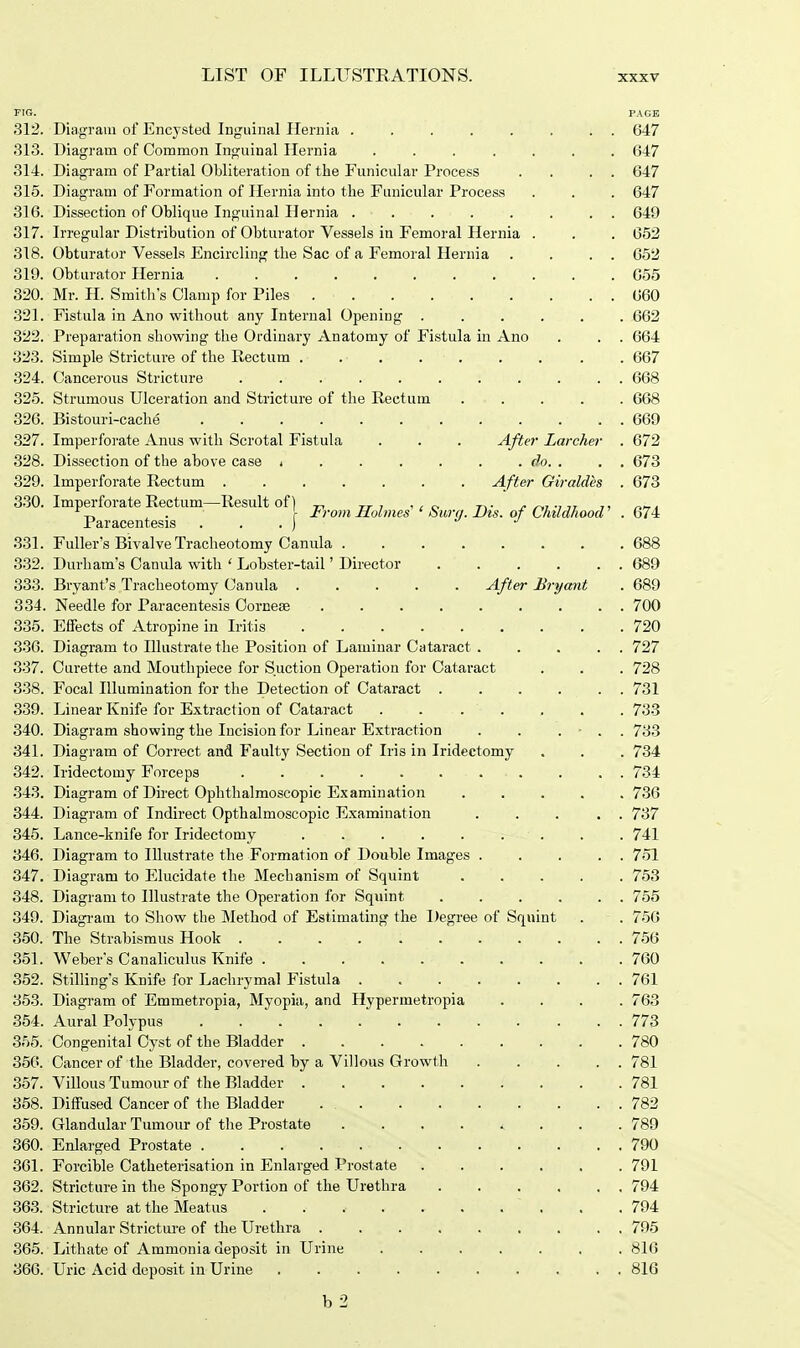 PIG. PAGE 312. Diagram of Encysted Inguinal Hernia 647 313. Diagram of Common Inguinal Hernia ....... 647 314. Diagram of Partial Obliteration of the Funicular Process . . . . 647 315. Diagram of Formation of Hernia into the Funicular Process . . . 647 316. Dissection of Oblique Inguinal Hernia . • . . . . . . . 649 317. Irregular Distribution of Obturator Vessels in Femoral Hernia . . . 652 318. Obturator Vessels Encircling the Sac of a Femoral Hernia . . . . 652 319. Obturator Hernia 655 320. Mr. H. Smith's Clamp for Piles 660 321. Fistula in Ano without any Internal Openiug 662 322. Preparation showing the Ordinary Anatomy of Fistula in Ano . . . 664 323. Simple Stricture of the Rectum . . . . . . . . . 667 324. Cancerous Stricture 668 325. Strumous Ulceration and Stricture of the Rectum ..... 668 326. Bistouri-cache 669 327. Imperforate Anus with Scrotal Fistula . . . After Larcher . 672 328. Dissection of the above case i . . . . . . do. . . . 673 329. Imperforate Rectum After Giraldes . 673 330. Imperforate Rectum—Result of} „ TT , wo ,.. . .,,, „„. r_ , . \ From Holmes ' Sura. Bis. of Childhood . 674 Paracentesis . . . ) J 831. Fuller's Bivalve Tracheotomy Canula 688 332. Durham's Canula with ' Lobster-tail' Director 689 333. Bryant's Tracheotomy Canula ..... After Bryant . 689 334. Needle for Paracentesis Cornea? ......... 700 335. Effects of Atropine in Iritis 720 336. Diagram to Illustrate the Position of Laminar Cataract 727 337. Curette and Mouthpiece for Suction Operation for Cataract . . . 728 338. Focal Illumination for the Detection of Cataract 731 339. Linear Knife for Extraction of Cataract ....... 733 340. Diagram showing the Incision for Linear Extraction . . . ■ . . 733 341. Diagram of Correct and Faulty Section of Iris in Iridectomy . . . 734 342. Iridectomy Forceps . . . 734 343. Diagram of Direct Ophthalmoscopic Examination 736 344. Diagram of Indirect Opthalmoscopic Examination ... . . 737 345. Lance-knife for Iridectomy . . . . . . . . .741 346. Diagram to Illustrate the Formation of Double Images 751 347. Diagram to Elucidate the Mechanism of Squint 753 348. Diagram to Illustrate the Operation for Squint 755 349. Diagram to Show the Method of Estimating the Degree of Squint . . 756 350. The Strabismus Hook . 756 351. Weber's Canaliculus Knife 760 352. Stilling's Knife for Lachrymal Fistula 761 353. Diagram of Emmetropia, Myopia, and Hypermetropia .... 763 354. Aural Polypus 773 355. Congenital Cyst of the Bladder 780 356. Cancer of the Bladder, covered by a Villous Growth 781 357. Villous Tumour of the Bladder 781 358. Diffused Cancer of the Bladder . 782 359. Glandular Tumour of the Prostate 789 360. Enlarged Prostate . . . . 790 361. Forcible Catheterisation in Enlarged Prostate 791 362. Stricture in the Spongy Portion of the Urethra ...... 794 363. Stricture at the Meatus . . . . . . . ' . . .794 364. Annular Stricture of the Urethra 795 365. Lithate of Ammonia deposit in Urine 816 366. Uric Acid deposit in Urine .......... 816 b 2