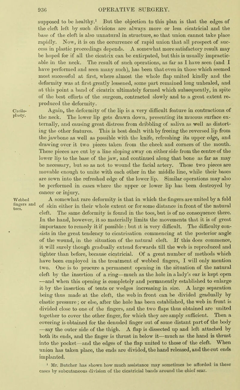 supposed to be healthy.1 But the objection to this plan is that the edges of the cleft left by such divisions are always more or less cicatricial and the base of the cleft is also unnatural in structure, so that union cannot take place rapidly. Now, it is on the occurrence of rapid union that all prospect of suc- cess in plastic proceedings depends. A somewhat more satisfactory result may be hoped for if all the cicatrix can be extirpated, but this is usually impractic- able in the neck. The result of such operations, as far as I have seen (and I have performed and seen many such), has been that even in those which seemed most successful at first, where almost the whole flap united kindly and the deformity was at first greatly lessened, some part remained long unhealed, and at this point a band of cicatrix ultimately formed which subsequently, in spite of the best efforts of the surgeon, contracted slowly and to a great extent re- produced the deformity. Cheilo- Again, the deformity of the lip is a very difficult feature in contractions of plasty. foe neck. The lower lip gets drawn down, presenting its mucous surface ex- ternally, and causing great distress from dribbling of saliva as well as distort- ing the other features. This is best dealt with by freeing the reversed lip from the jawbone as well as possible with the knife, refreshing its upper edge, and drawing over it two pieces taken from the cheek and corners of the mouth. These pieces are cut by a line sloping away on either side from the centre of the lower lip to the base of the jaw, and continued along that bone as far as may be necessary, but so as not to wound the facial artery. These two pieces are movable enough to unite with each other in the middle line, while their bases are sewn into the refreshed edge of the lower lip. Similar operations may also be performed in cases where the upper or lower lip has been destroyed by cancer or injury. Webbed A somewhat rare deformity is that in which the fingers are united by a fold fingers and Qf fafa either in their whole extent or for some distance in front of the natural toes. cleft. The same deformity is found in the toes, but is of no consequence there. In the hand, however, it so materially limits the movements that it is of great importance to remedy it if possible : but it is very difficult. The difficulty con- sists in the great tendency to cicatrisation commencing at the posterior angle of the wound, in the situation of the natural cleft. If this does commence, it will surely though gradually extend forwards till the web is reproduced and tighter than before, because cicatricial. Of a great number of methods which have been employed in the treatment of webbed fingers, I will only mention two. One is to procure a permanent opening in the situation of the natural cleft by the insertion of a ring—much as the hole in a lady's ear is kept open —and when this opening is completely and permanently established to enlarge it by the insertion of tents or wedges increasing in size. A large separation being thus made at the cleft, the web in front can be divided gradually by elastic pressure; or else, after the hole has been established, the web in front is divided close to one of the fingers, and the two flaps thus obtained are united together to cover the other finger, for which they are amply sufficient. Then a covering is obtained for the denuded finger out of some distant part of the body —say the outer side of the thigh. A flap is dissected up and left attached by both its ends, and the finger is thrust in below it—much as the hand is thrust into the pocket—and the edges of the flap united to those of the cleft. When union has taken place, the ends are divided, the hand released, and the cut ends implanted. 1 Mr. Butcher has shown how much assistance may sometimes be afforded in these cases by subcutaneous division of the cicatricial bands around the chief scar.