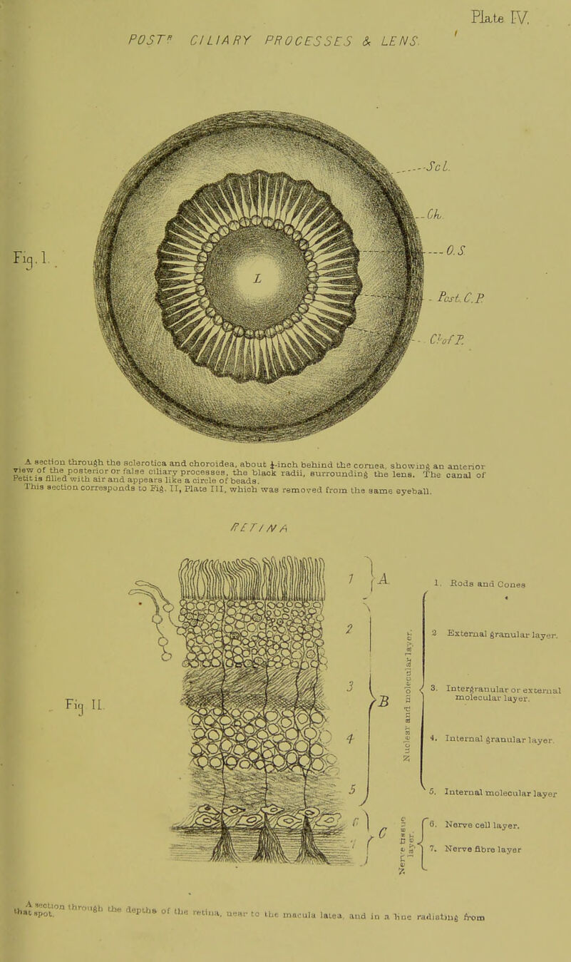 Plate IV. POST CILIARY PROCESSES & LENS. ' Fiq.l. A section through the sclerotica and choroidea, about J-inch behind the cornea, showinA an anterior ^fJ'P'J^ POBtecior or fa.]se ciliary procesaea. the black radii. Burrounding the lens. The canal of Petit 18 filled OTHh air and appears lilie a circle of beads = ^.auu This section corresponds to Fig. II, Plate III, which was removed from the same eyeball. /?£r/AfA 1. Hods and Cones 2 External granular layer. 3. Intergranular or external molecular layer. 4. Internal granular layer. 5. Internal molecular layer B. Nerve cell layer. 7. Nerve fibre layer thatpot,^^*'' 'i«P'-b» of the retina, near to the macula latea, and in line ra.l,«t,ng fron.