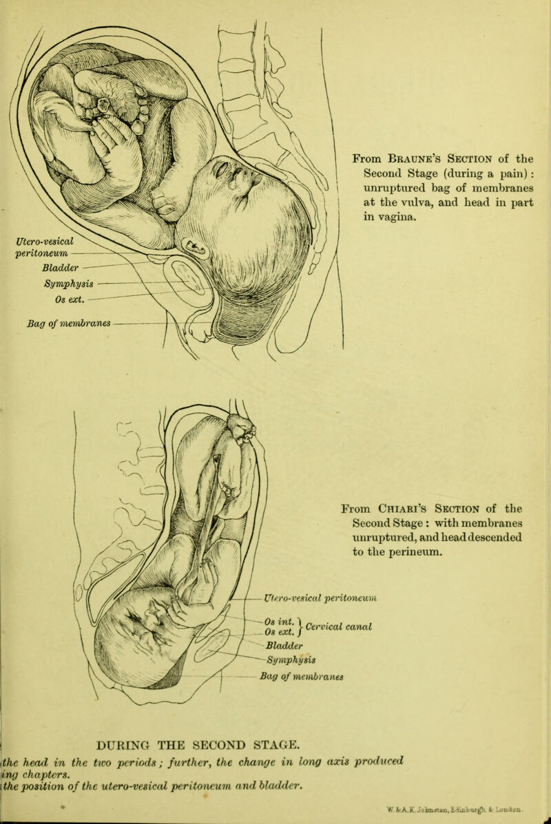 Chiari's Section of tlie nd Stage: with membranes iptui ed, and head descended le perineum. DURING THE SECOND STAGE. ithe head in the tico periods; further, the change in long axis produced ing chapters. ithe position of the utero-vesic(U peritoneum and bladder. L_ ^