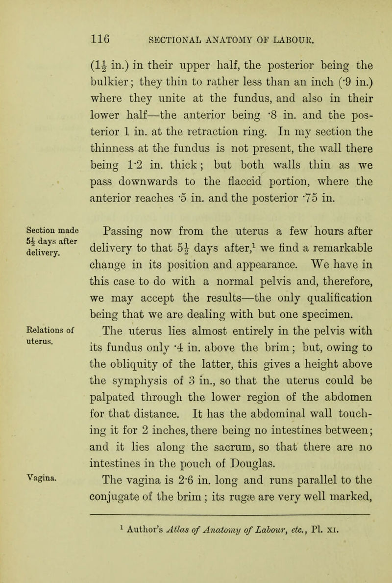 (IJ in.) in their upper half, the posterior being the bulkier; they thin to rather less than an inch (*9 in.) where they unite at the fundus, and also in their lower half—the anterior being 8 in. and the pos- terior 1 in. at the retraction ring. In my section the thinness at the fundus is not present, the wall there being 1'2 in. thick; but both walls thin as we pass downwards to the flaccid portion, where the anterior reaches '5 in. and the posterior 75 in. Section made 5^ days after delivery. Eelations of uterus. Vagina. Passing now from the uterus a few hours after delivery to that 5J days after,^ we find a remarkable change in its position and appearance. We have in this case to do with a normal pelvis and, therefore, we may accept the results—the only qualification being that we are dealing with but one specimen. The uterus lies almost entirely in the pelvis with its fundus only '4 in. above the brim; but, owing to the obliquity of the latter, this gives a height above the symphysis of 3 in., so that the uterus could be palpated through the lower region of the abdomen for that distance. It has the abdominal wall touch- ing it for 2 inches, there being no intestines between; and it lies along the sacrum, so that there are no intestines in the pouch of Douglas. The vagina is 2*6 in. long and runs parallel to the conjugate of the brim ; its rugae are very well marked, ^ Author's Atlas of Anatomy of Labour, etc., PI. xi.