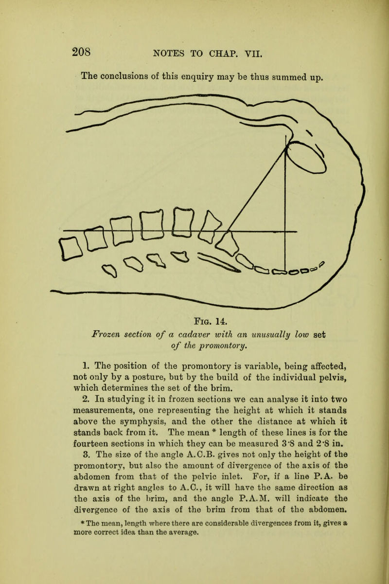 The conclusions of this enquiry may be thus summed up. Fig. 14. Frozen section of a cadaver with an unusually low set of the promontory. 1. The position of the promontory is variable, being affected, not only by a posture, but by the build of the individual pelvis, which determines the set of the brim. 2. In studying it in frozen sections we can analyse it into two measurements, one representing the height at which it stands above the symphysis, and the other the distance at which it stands back from it. The mean * length of these lines is for the fourteen sections in which they can be measured 3*8 and 2*8 in. 3. The size of the angle A.C.B. gives not only the height of the promontory, but also the amount of divergence of the axis of the abdomen from that of the pelvic inlet. For, if a line P. A. be drawn at right angles to A.C., it will have the same direction as the axis of the brim, and the angle P.A.M. will indicate the divergence of the axis of the brim from that of the abdomen. *The mean, length where there are considerable divergences from it, gives a more correct idea than the average.