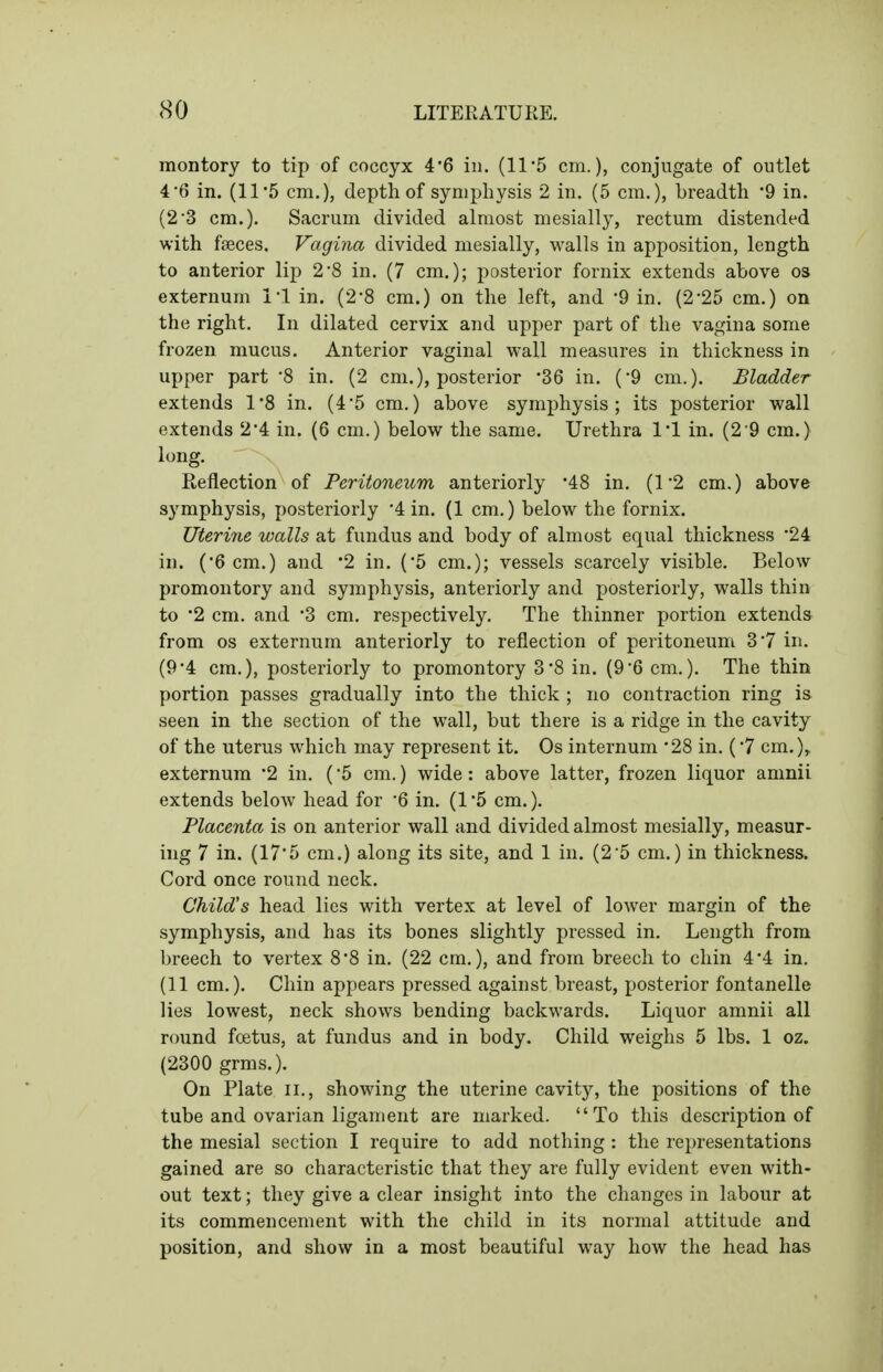 montory to tip of coccyx 4*6 in. (11'5 cm.), conjugate of outlet 4'6 in. (11*5 cm.), depth of symphysis 2 in. (5 cm.), breadth '9 in. (2-3 cm.). Sacrum divided almost mesially, rectum distended with fseces. Vagina divided mesially, v^^alls in apposition, length to anterior lip 2*8 in. (7 cm.); posterior fornix extends above o» externum 11 in. (2-8 cm.) on the left, and *9 in. (2-25 cm.) on the right. In dilated cervix and upper part of the vagina some frozen mucus. Anterior vaginal wall measures in thickness in upper part '8 in. (2 cm.), posterior '36 in. ('9 cm.). Bladder extends 1*8 in. (4*5 cm.) above symphysis; its posterior wall extends 2'4 in. (6 cm.) below the same. Urethra I'l in. (2 9 cm.) long. Reflection of Peritoneum anteriorly '48 in. (1 2 cm.) above symphysis, posteriorly 4 in. (1 cm.) below the fornix. Uterine walls at fundus and body of almost equal thickness '24 in. ('Gem.) and '2 in. (5 cm.); vessels scarcely visible. Below promontory and symphysis, anteriorly and posteriorly, walls thin to '2 cm. and '3 cm. respectively. The thinner portion extends from OS externum anteriorly to reflection of peritoneum 37 in. (94 cm.), posteriorly to promontory 3*8 in. (9'6 cm.). The thin portion passes gradually into the thick ; no contraction ring is seen in the section of the wall, but there is a ridge in the cavity of the uterus which may represent it. Os internum 28 in. (7 cm.), externum '2 in. (5 cm.) wide: above latter, frozen liquor amnii extends below head for 6 in. (1'5 cm.). Placenta is on anterior wall and divided almost mesially, measur- ing 7 in. (175 cm.) along its site, and 1 in. (2'5 cm.) in thickness. Cord once round neck. Child's head lies with vertex at level of lower margin of the symphysis, and has its bones slightly pressed in. Length from breech to vertex 88 in. (22 cm.), and from breech to chin 4*4 in. (11 cm.). Chin appears pressed against breast, posterior fontanelle lies lowest, neck shows bending backwards. Liquor amnii all round foetus, at fundus and in body. Child weighs 5 lbs. 1 oz. (2300 grms.). On Plate ii., showing the uterine cavitj'-, the positions of the tube and ovarian ligament are marked. To this description of the mesial section I require to add nothing: the representations gained are so characteristic that they are fully evident even with- out text; they give a clear insight into the changes in labour at its commencement with the child in its normal attitude and position, and show in a most beautiful way how the head has