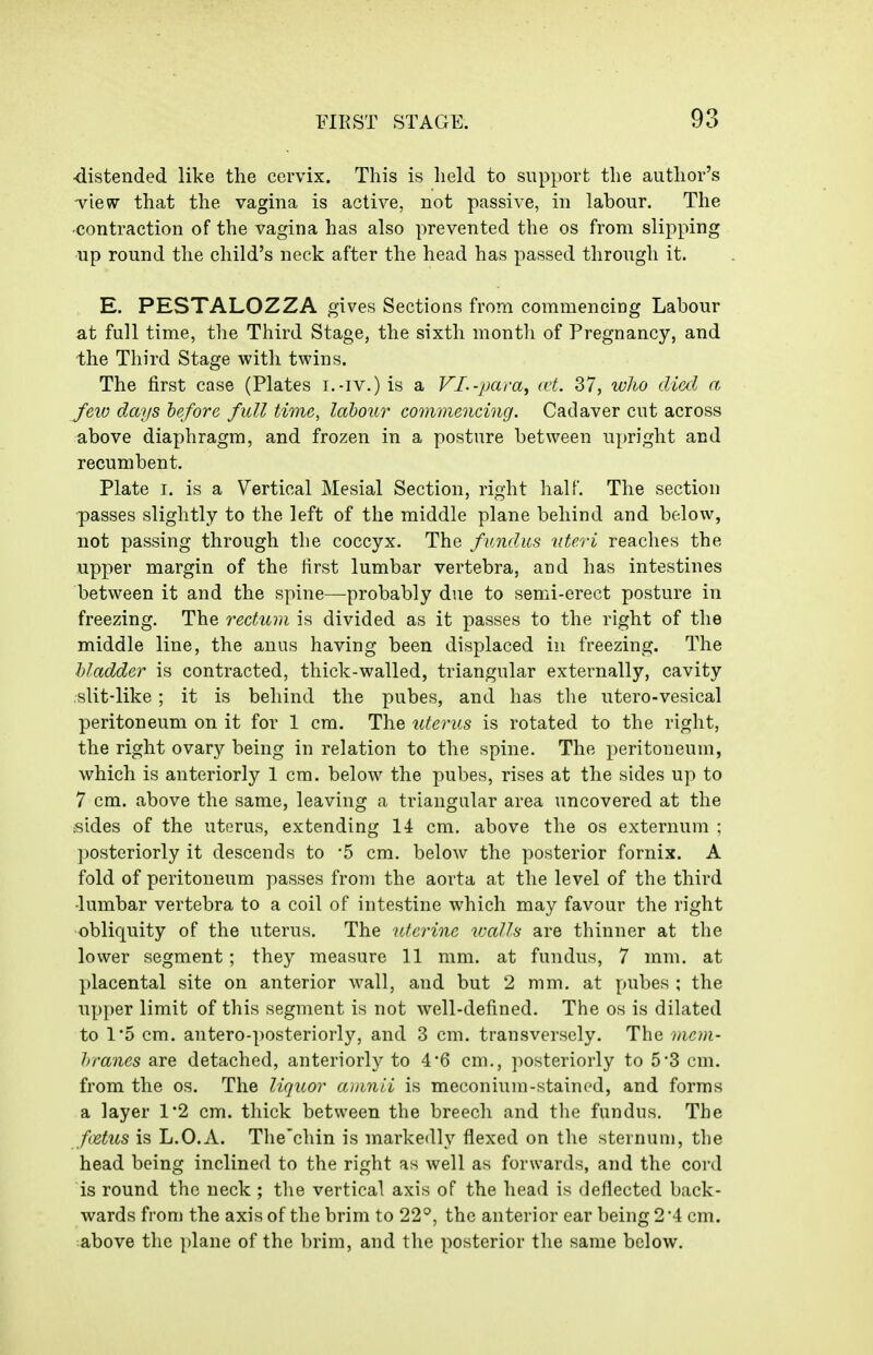 ■distended like the cervix. This is held to support the author's -view that the vagina is active, not passive, in labour. The ■contraction of the vagina has also prevented the os from slipping up round the child's neck after the head has passed through it. E. PESTALOZZA gives Sections from commencing Labour at full time, the Third Stage, the sixth month of Pregnancy, and the Third Stage with twins. The first case (Plates i.-iv.) is a VL-para^ ai. 37, who died a. feiv days before full time, labour commencing. Cadaver cut across above diaphragm, and frozen in a posture between upright and recumbent. Plate I. is a Vertical Mesial Section, right lialf. The section passes slightly to the left of the middle plane behind and below, not passing through the coccyx. The fundus uteri reaches the upper margin of the first lumbar vertebra, and has intestines between it and the spine—probably due to semi-erect posture in freezing. The rectum is divided as it passes to the right of the middle line, the anus having been displaced in freezing. The bladder is contracted, thick-walled, triangular externally, cavity slitdike; it is behind the pubes, and has the utero-vesical peritoneum on it for 1 cm. The uterus is rotated to the right, the right ovary being in relation to the spine. The peritoneum, which is anteriorly 1 cm. below the pubes, rises at the sides up to 7 cm. above the same, leaving a triangular area uncovered at the sides of the uterus, extending 14 cm, above the os externum ; ])Osteriorly it descends to '5 cm. below the posterior fornix. A fold of peritoneum passes from the aorta at the level of the third •lumbar vertebra to a coil of intestine which may favour the right obliquity of the uterus. The uterine walls are thinner at the lower segment; they measure 11 mm. at fundus, 7 mm. at placental site on anterior wall, and but 2 mm. at pubes ; the upper limit of this segment is not well-defined. The os is dilated to 1*5 cm. antero-posteriorly, and 3 cm. transversely. The ))icm- hranes are detached, anteriorly to 4*6 cm., posteriorly to 53 cm. from the os. The liquor amnii is meconium-stained, and forms a layer 1*2 cm. thick between the breech and the fundus. The fUus is L.O.A. The'chin is markedly flexed on the sternum, the head being inclined to the right as well as forwards, and the cord is round the neck ; the vertical axis of the head is deflected back- wards from the axis of the brim to 22°, the anterior ear being 2*4 cm. above the plane of the brim, and the ])osterior tlie same below.