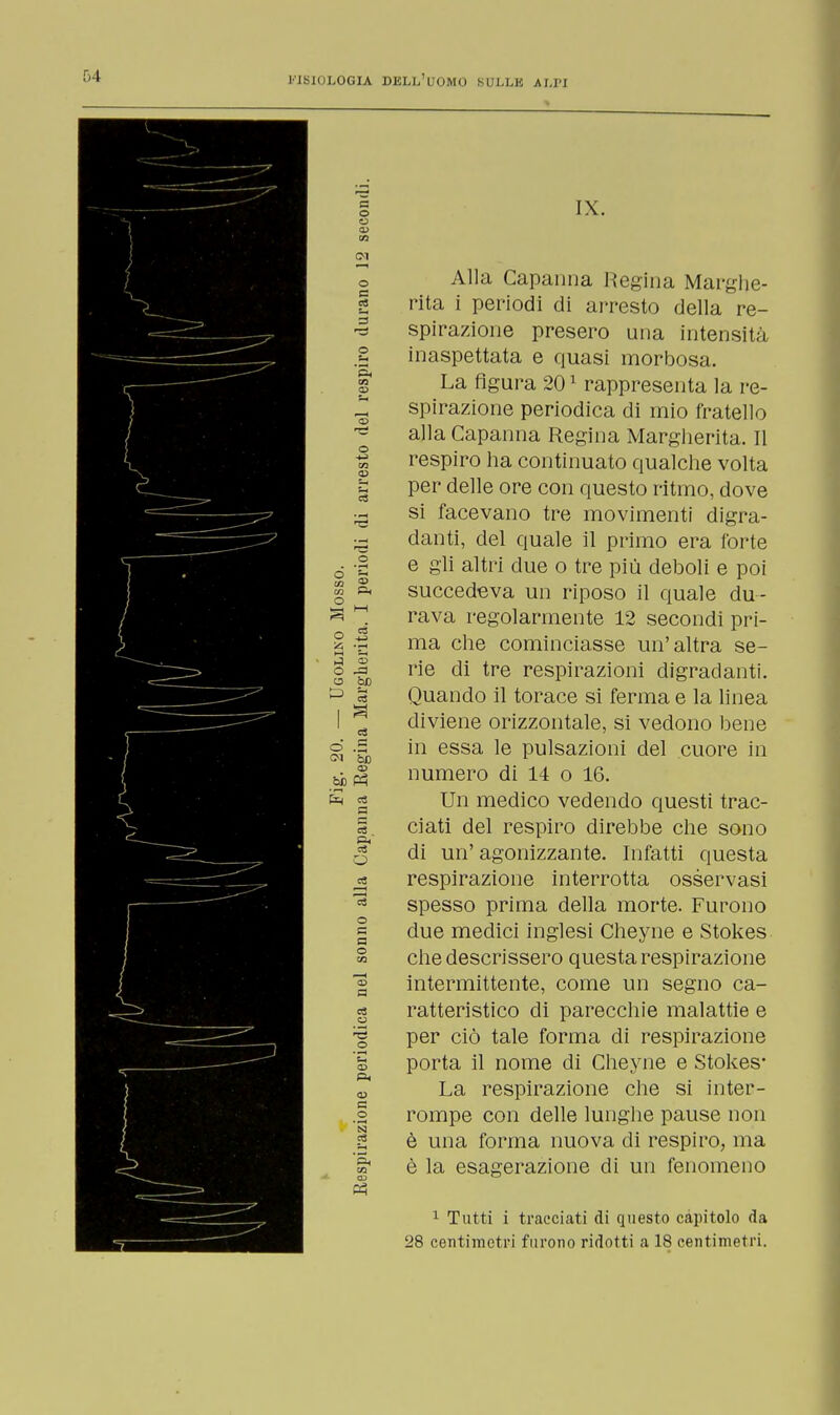 o a ED IO IX. o a a O S s CO P< o ^ O ^3 a òd lì 0 .5 01 bD 03 bi) Ph a és P< c3 o o = o 03 a o 03 03 e _© '3 Oh co 03 Alla Capanna Regina Marghe- rita i periodi di arresto della re- spirazione presero una intensità inaspettata e quasi morbosa. La figura 201 rappresenta la re- spirazione periodica di mio fratello alla Capanna Regina Margherita. Il respiro ha continuato qualche volta per delle ore con questo ritmo, dove si facevano tre movimenti digra- danti, del quale il primo era forte e gli altri due o tre più deboli e poi succedeva un riposo il quale du- rava regolarmente 12 secondi pri- ma che cominciasse un'altra se- rie di tre respirazioni digradanti. Quando il torace si ferma e la linea diviene orizzontale, si vedono bene in essa le pulsazioni del cuore in numero di 14 o 16. Un medico vedendo questi trac- ciati del respiro direbbe che sono di un' agonizzante. Infatti questa respirazione interrotta osservasi spesso prima della morte. Furono due medici inglesi Cheyne e Stokes che descrissero questa respirazione intermittente, come un segno ca- ratteristico di parecchie malattie e per ciò tale forma di respirazione porta il nome di Cheyne e Stokes* La respirazione che si inter- rompe con delle lunghe pause non è una forma nuova di respiro, ma è la esagerazione di un fenomeno 1 Tutti i tracciati di questo capitolo da 28 centimetri furono ridotti a 18 centimetri.