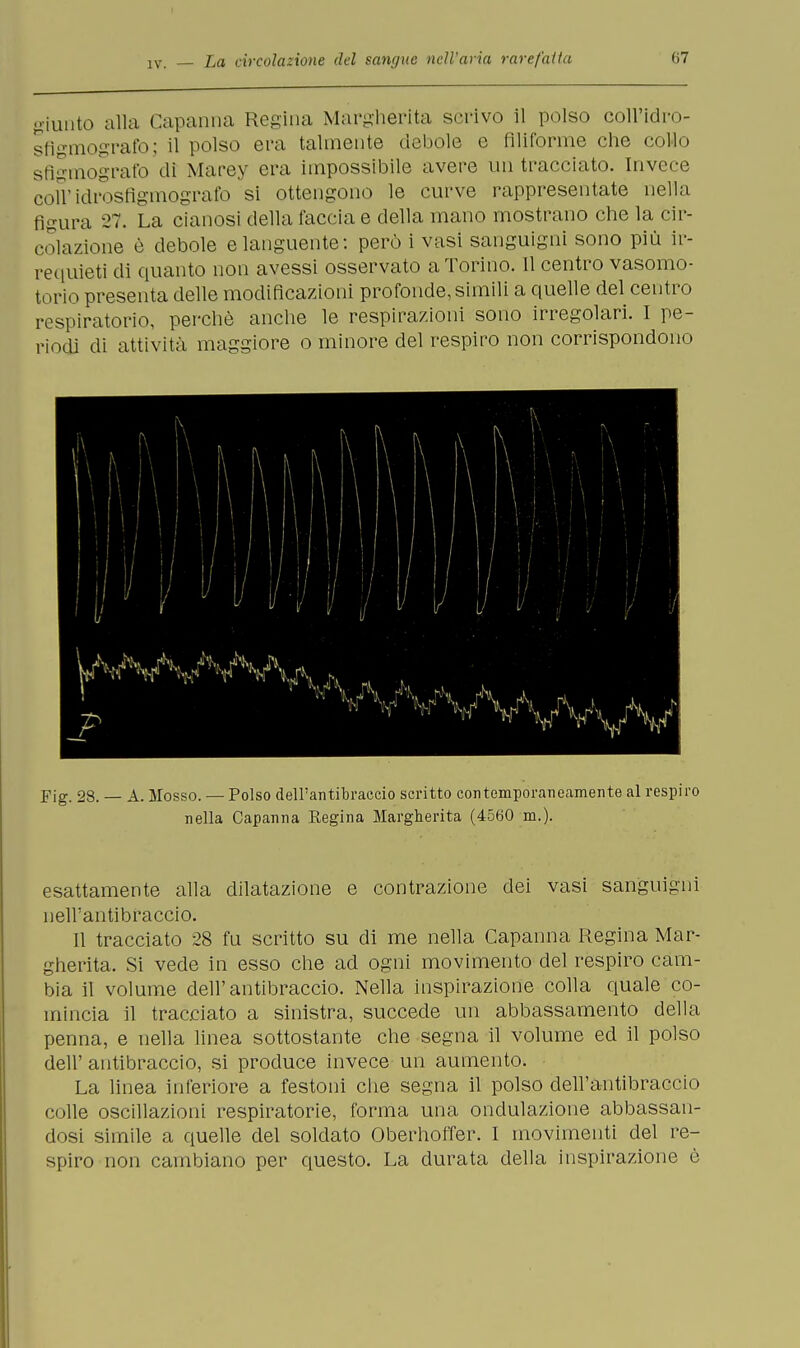giunto alla Capanna Regina Margherita scrivo il polso coll'idro- sfigmografo; il polso era talmente debole e filiforme che cotto sfigmografo dì Marey era impossibile avere un tracciato. Invece coU'idrosfigmografo si ottengono le curve rappresentate nella figura 27. La cianosi della faccia e della mano mostrano che la cir- colazione è debole e languente: però i vasi sanguigni sono più ir- requieti di quanto non avessi osservato a Torino. Il centro vasomo- torio presenta delle modificazioni profonde, simili a quelle del centro respiratorio, perchè anche le respirazioni sono irregolari. I pe- riodi di attività maggiore o minore del respiro non corrispondono Fig. 28. — A. Mosso. — Polso dell'antibraccio scritto contemporaneamente al respiro nella Capanna Regina Margherita (4560 m.). esattamente alla dilatazione e contrazione dei vasi sanguigni nell'antibraccio. Il tracciato 28 fu scritto su di me nella Capanna Regina Mar- gherita. Si vede in esso che ad ogni movimento del respiro cam- bia il volume dell'antibraccio. Nella inspirazione colla quale co- mincia il tracciato a sinistra, succede un abbassamento della penna, e nella linea sottostante che segna il volume ed il polso dell' antibraccio, si produce invece un aumento. La linea inferiore a festoni che segna il polso dell'antibraccio colle oscillazioni respiratorie, forma una ondulazione abbassan- dosi simile a quelle del soldato Oberhoffer. I movimenti del re- spiro non cambiano per questo. La durata della inspirazione è