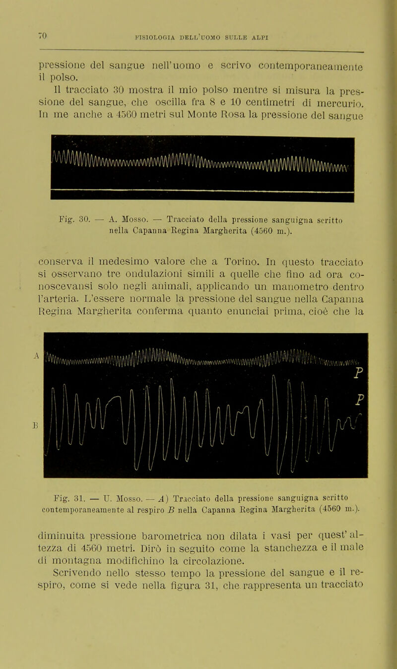 pressione del sangue nell'uomo e scrivo contemporaneamente il polso. 11 tracciato 30 mostra il mio polso mentre si misura la pres- sione del sangue, che oscilla fra 8 e 10 centimetri di mercurio. In me anche a 1=560 metri sul Monte Rosa la pressione del sangue Fig. 30. — A. Mosso. — Tracciato della pressione sanguigna scritto nella Capanna Regina Margherita (4560 m.). conserva il medesimo valore che a Torino. In questo tracciato si osservano tre ondulazioni simili a quelle che fino ad ora co- noscevansi solo negli animali, applicando un manometro dentro l'arteria. L'essere normale la pressione del sangue nella Capanna Regina Margherita conferma quanto enunciai prima, cioè che la lì Fig. 31. — U. Mosso. — A) Tracciato della pressione sanguigna scritto contemporaneamente al respiro B nella Capanna Regina Margherita (4560 m.). diminuita pressione barometrica non dilata i vasi per quest' al- tezza di 45G0 metri. Dirò in seguito come la stanchezza e il male di montagna modifichino la circolazione. Scrivendo nello stesso tempo la pressione del sangue e il re- spiro, come si vede nella figura 31, che rappresenta un tracciato
