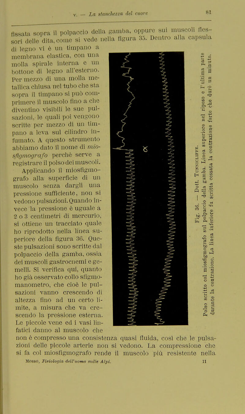 fissata sopra il polpaccio della gamba, oppure sui muscoli fles- sori delle dita, come si vede nella figura 35. Dentro alla capsula di legno vi è un timpano a membrana elastica, con una molla spirale interna e un bottone di legno all'esterno. Per mezzo di una molla me- tallica chiusa nel tubo che sta sopra il timpano si può com- primere il muscolo fino a che diventino visibili le sue pul- sazioni, le quali poi vengono scritte per mezzo di un tim- pano a leva sul cilindro in- fumato. A questo strumento abbiamo dato il nome di mio- sfigmografo perchè serve a registrare il polso dei muscoli. Applicando il miosfigmo- grafo alla superficie di un muscolo senza dargli una pressione sufficiente, non si vedono pulsazioni. Quando in- vece la pressione è uguale a 2 o 3 centimetri di mercurio, si ottiene un tracciato quale ho riprodotto nella linea su- periore della figura 36. Que- ste pulsazioni sono scritte dal polpaccio della gamba, ossia dei muscoli gastrocnemi e ge- melli. Si verifica qui, quanto ho già osservato collo sfigmo- manometro, che cioè le pul- sazioni vanno crescendo di altezza fino ad un certo li- mite, a misura che va cre- scendo la pressione esterna. Le piccole vene ed i vasi lin- fatici danno al muscolo che non è compresso una consistenza quasi fluida, così che le pulsa- zioni delle piccole arterie non si vedono. La compressione che si fa col miosfigmografo rende il muscolo più resistente nella Mosso, Fisiologia dM'twmo sulle Alpi. 11