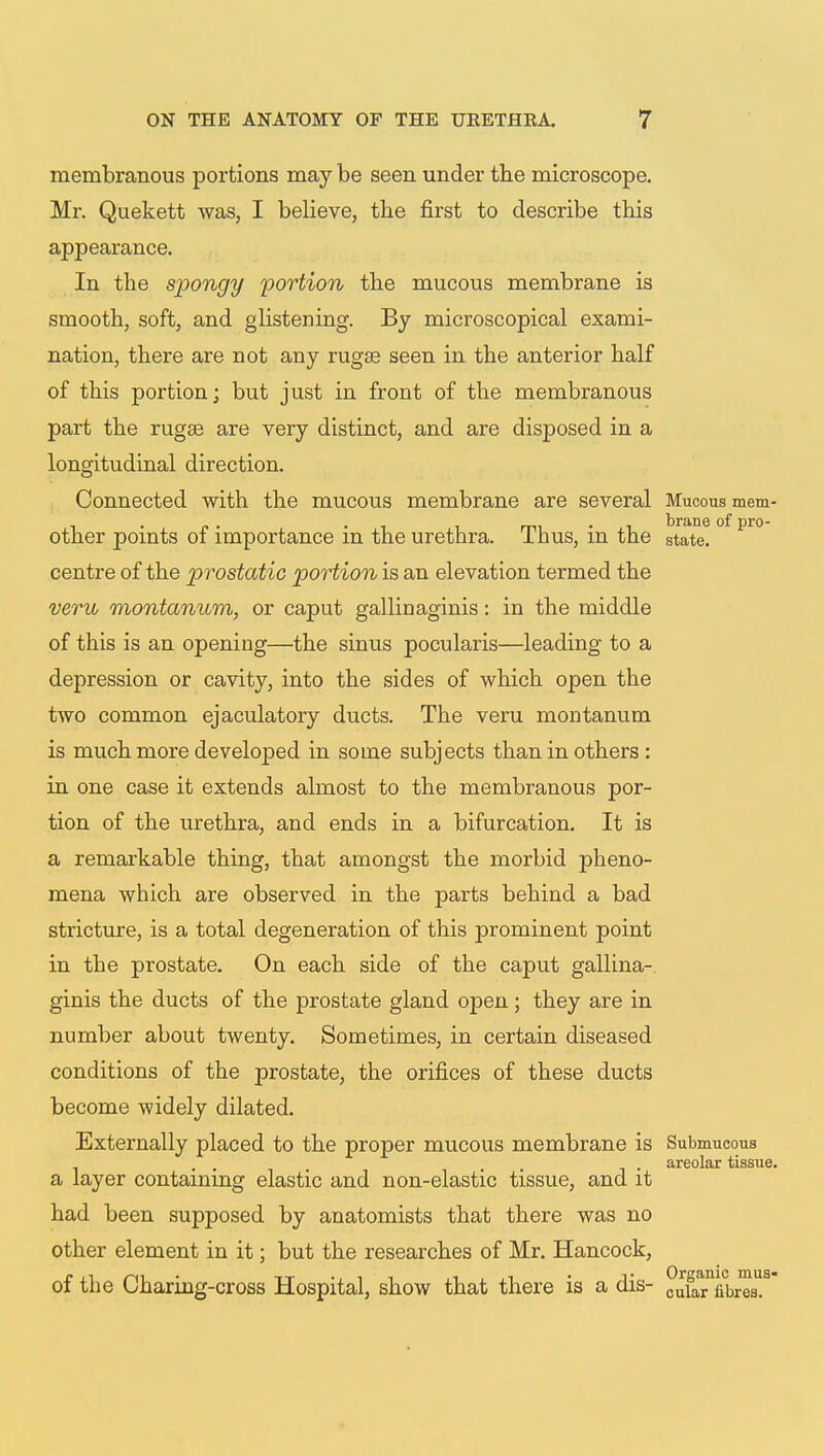 membranous portions may be seen under the microscope. Mr. Quekett was, I believe, the first to describe this appearance. In the spongy portion the mucous membrane is smooth, soft, and glistening. By microscopical exami- nation, there are not any rugae seen in the anterior half of this portion; but just in front of the membranous part the rugae are very distinct, and are disposed in a longitudinal direction. Connected with the mucous membrane are several Mucous mem- ■ -i mi • i brane of pro- otner points oi importance m the urethra. 1 hus, m the state, centre of the prostatic portion is an elevation termed the veru montanum, or caput gallinaginis: in the middle of this is an opening—the sinus pocularis—leading to a depression or cavity, into the sides of which open the two common ejaculatory ducts. The veru montanum is much more developed in some subjects than in others : in one case it extends almost to the membranous por- tion of the urethra, and ends in a bifurcation. It is a remarkable thing, that amongst the morbid pheno- mena which are observed in the parts behind a bad stricture, is a total degeneration of this prominent point in the prostate. On each side of the caput gallina- ginis the ducts of the prostate gland open; they are in number about twenty. Sometimes, in certain diseased conditions of the prostate, the orifices of these ducts become widely dilated. Externally placed to the proper mucous membrane is Submucous ... . . . areolar tissue. a layer containing elastic and non-elastic tissue, and it had been supposed by anatomists that there was no other element in it; but the researches of Mr. Hancock, of the Charing-cross Hospital, show that there is a dis- cuTaTnbresl3