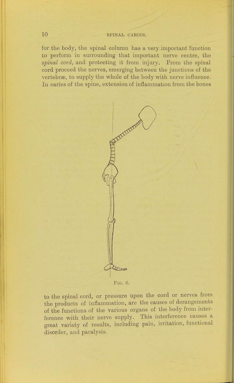 for the body, the spinal column has a very important function to perform in surrounding that important nerve centre, the spinal cord, and protecting it from injury. From the spinal cord proceed the nerves, emerging between the junctions of the vertebrae, to supply the whole of the body with nerve influence. In caries of the spine, extension of inflammation from the bones to the spinal cord, or pressure upon the cord or nerves from the products of inflammation, are the causes of derangements of the functions of the various organs of the body from inter- ference with their nerve supply. This interference causes a great variety of results, including pain, irritation, functional disorder, and paralysis. Fig. C.