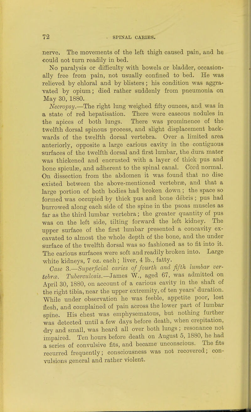 nerve. The movements of the left thigh caused pain, and he ■could not turn readily in bed. No paralysis or difficulty with bowels or bladder, occasion- ally free from pain, not usually confined to bed. He was relieved by chloral and by blisters; his condition was aggra- vated by opium; died rather suddenly from pneumonia on May 30, 1880. Necropsy.—The right lung weighed fifty ounces, and was in a state of red hepatisation. There were caseous nodules in the apices of both lungs. There was prominence of the twelfth dorsal spinous process, and slight displacement back- wards of the twelfth dorsal vertebra. Over a limited area anteriorly, opposite a large carious cavity in the contiguous ■surfaces of the twelfth dorsal and first lumbar, the dura mater was thickened and encrusted with a layer of thick pus and bone spiculaB, and adherent to the spinal canal. Cord normal. On dissection from the abdomen it was found that no disc ■existed between the above-mentioned vertebrae, and that a large portion of both bodies had broken down ; the space so formed was occupied by thick pus and bone debris ; pus had burrowed along each side of the spine in the psoas muscles as far as the third lumbar vertebra; the greater quantity of pus was on the left side, tilting forward the left kidney. The upper surface of the first lumbar presented a concavity ex- cavated to almost the whole depth of the bone, and the under surface of the twelfth dorsal was so fashioned as to fit into it. The carious surfaces were soft and readily broken into. Large white kidneys, 7 oz. each; liver, 4 lb., fatty. Case 2,.—Superficial caries of fourth and fifth lumbar ver- tebra. Tuberculosis.—Ja.mes W., aged 67, was admitted on April 30, 1880, on account of a carious cavity in the shaft of the right tibia, near the upper extremity, of ten years' duration. While under observation he was feeble, appetite poor, lost flesh, and complained of pain across the lower part of lumbar spine. His chest was emphysematous, but nothing further was detected until a few days before death, when crepitation, dry and small, was heard all over both lungs ; resonance not impaired. Ten hours before death on August 5, 1880, he had a series of convulsive fits, and became unconscious. The fits recurred frequently; consciousness was not recovered; con- vulsions general and rather violent.