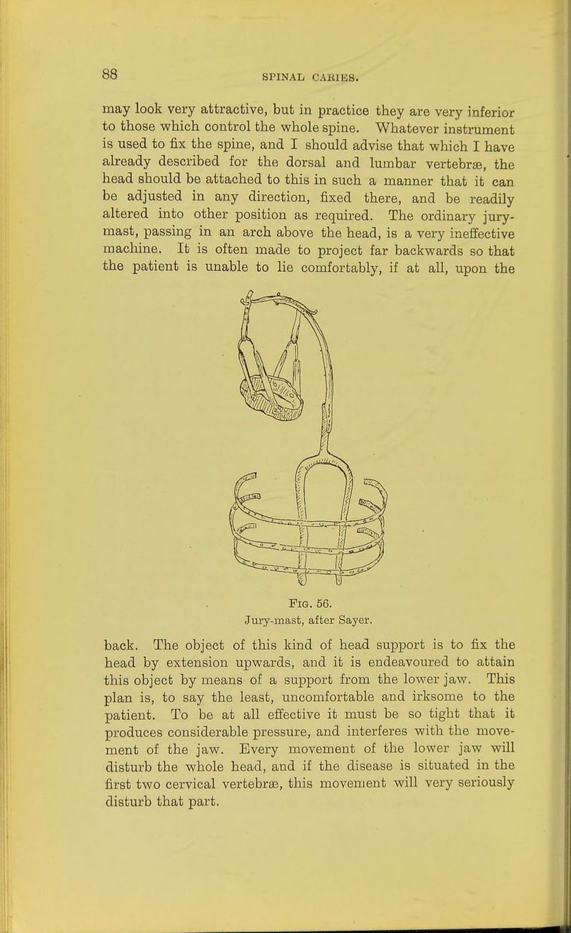 may look very attractive, but in practice they are very inferior to those which control the whole spine. Whatever instrument is used to fix the spine, and I should advise that which I have ahready described for the dorsal and lumbar vertebrae, the head should be attached to this in such a manner that it can be adjusted in any direction, fixed there, and be readily altered into other position as required. The ordinary jury- mast, passing in an arch above the head, is a very ineffective machine. It is often made to project far backwards so that the patient is unable to lie comfortably, if at all, upon the Fig. 56. Jury-mast, after Sayer. back. The object of this kind of head support is to fix the head by extension upwards, and it is endeavoured to attain this object by means of a support from the lower jaw. This plan is, to say the least, uncomfortable and irksome to the patient. To be at all effective it must be so tight that it produces considerable pressure, and interferes with the move- ment of the jaw. Every movement of the lower jaw will disturb the whole head, and if the disease is situated in the first two cervical vertebras, this movement will very seriously disturb that part.