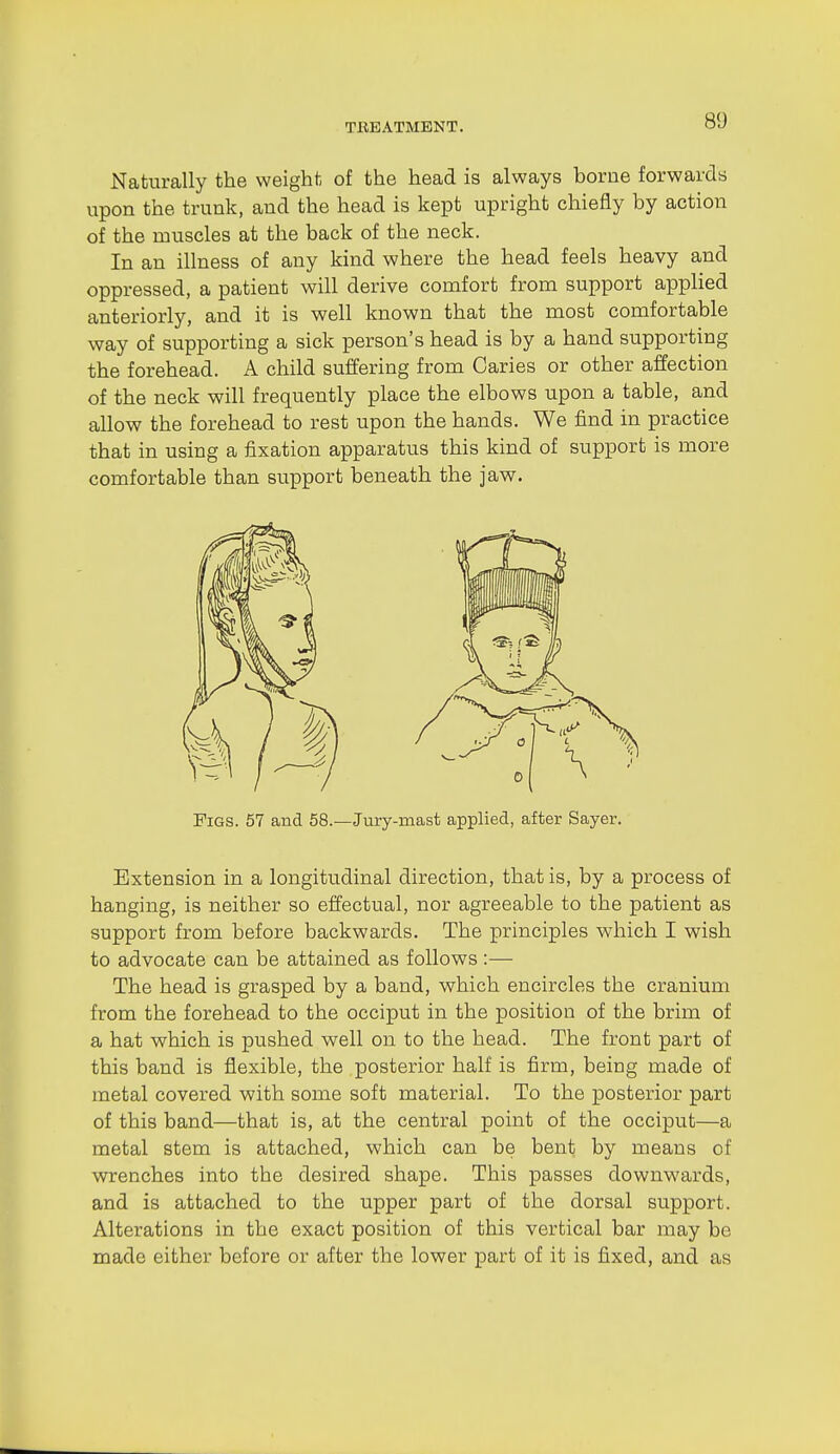 Naturally the weight of the head is always borne forwards upon the trunk, and the head is kept upright chiefly by action of the muscles at the back of the neck. In an illness of any kind where the head feels heavy and oppressed, a patient will derive comfort from support applied anteriorly, and it is well known that the most comfortable way of supporting a sick person's head is by a hand supporting the forehead. A child suffering from Caries or other affection of the neck will frequently place the elbows upon a table, and allow the forehead to rest upon the hands. We find in practice that in using a fixation apparatus this kind of support is more comfortable than support beneath the jaw. Pigs. 57 and 58.—Jiiry-mast applied, after Sayer. Extension in a longitudinal direction, that is, by a process of hanging, is neither so effectual, nor agreeable to the patient as support from before backwards. The principles which I wish to advocate can be attained as follows :— The head is grasped by a band, which encircles the cranium from the forehead to the occiput in the position of the brim of a hat which is pushed well on to the head. The front part of this band is flexible, the posterior half is firm, being made of metal covered with some soft material. To the posterior part of this band—that is, at the central point of the occiput—a metal stem is attached, which can be bent by means of wrenches into the desired shape. This passes downw^ards, and is attached to the upper part of the dorsal support. Alterations in the exact position of this vertical bar may be made either before or after the lower part of it is fixed, and as