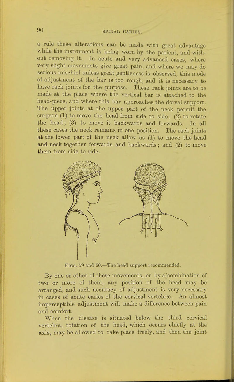 a rule these alterations can be made with great advantage while the instrument is being worn by the patient, and with- out removing it. In acute and very advanced cases, where very slight movements give great pain, and where we may do serious mischief unless great gentleness is observed, this mode of adjustment of the bar is too rough, and it is necessary to have rack joints for the purpose. These rack joints are to be made at the place where the vertical bar is attached to the head-piece, and where this bar approaches the dorsal support. The upper joints at the upper part of the neck permit the surgeon (1) to move the head from side to side; (2) to rotate the head; (3) to move it backwards and forwards. In all these cases the neck remains in one position. The rack joints at the lower part of the neck allow us (1) to move the head and neck together forwards and backwards; and (2) to move them from side to side. Figs. 59 and 60.—The head support recommended. By one or other of these movements, or by acombination of two or more of them, any position of the head may be arranged, and such accuracy of adjustment is very necessary in cases of acute caries of the cervical vertebrae. An almost imperceptible adjustment will make a difference between pain and comfort. When the disease is situated below the third cervical vertebra, rotation of the head, which occurs chiefly at the axis, may be allowed to take place freely, and then the joint