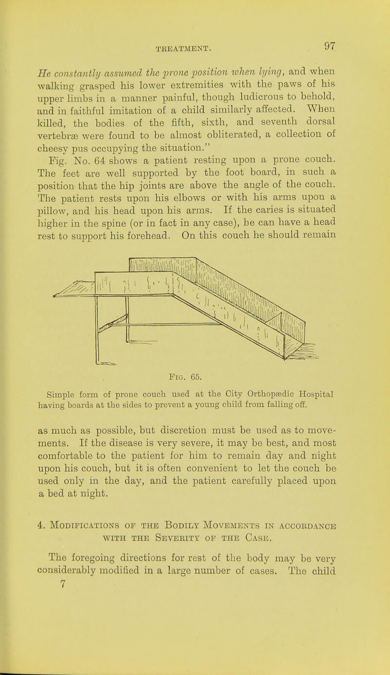 He constantly assumed the prone position luhen lying, and when walking grasped his lower extremities with the paws of his upper hmbs in a manner painful, though ludicrous to behold, and in faithful imitation of a child similarly affected. When killed, the bodies of the fifth, sixth, and seventh dorsal vertebrae were found to be almost obliterated, a collection of cheesy pus occupying the situation. Fig. No. 64 shows a patient resting upon a prone couch. The feet are well supported by the foot board, in such a position that the hip joints are above the angle of the couch. The patient rests upon his elbows or with his arms upon a pillow, and his head upon his arms. If the caries is situated higher in the spine (or in fact in any case), he can have a head rest to support his forehead. On this couch he should remain Fig. 65. Simple form of proae couch used at the City Orthopaedic Hospital having boards at the sides to prevent a young child from falling ofi. as much as possible, but discretion must be used as to move- ments. If the disease is very severe, it may be best, and most comfortable to the patient for him to remain day and night upon his couch, but it is often convenient to let the couch be used only in the day, and the patient carefully placed upon a bed at night. 4. Modifications of the Bodily Movements in accoedance WITH THE SeVEEITY OF THE GaSE. The foregoing directions for rest of the body may be very considerably modified in a large number of cases. The child 7