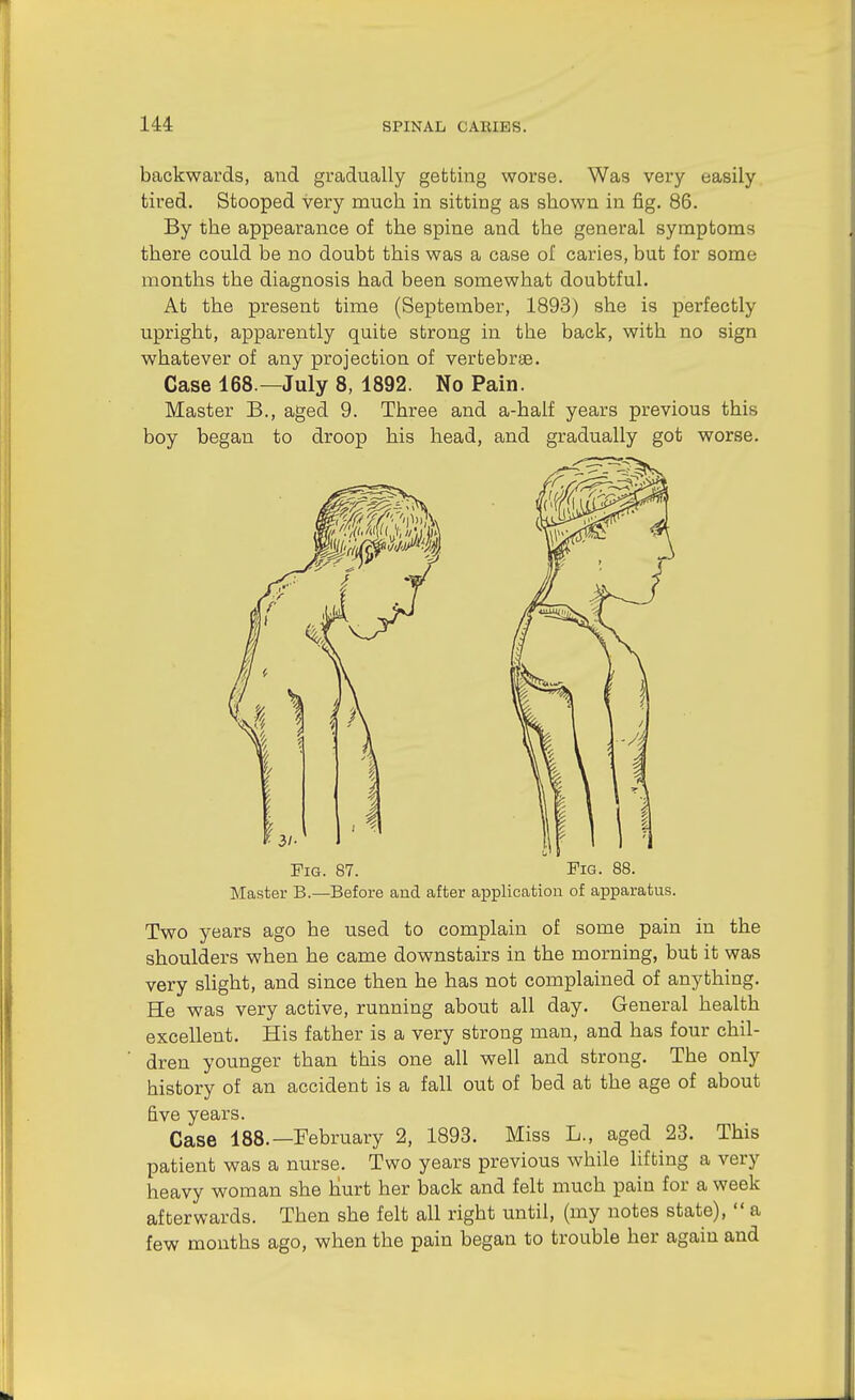 backwards, and gradually getting worse. Was very easily tired. Stooped very much in sitting as shown in fig. 86. By the appearance of the spine and the general symptoms there could be no doubt this was a case of caries, but for some months the diagnosis had been somewhat doubtful. At the present time (September, 1893) she is perfectly upright, apparently quite strong in the back, with no sign whatever of any projection of vertebrae. Case 168.—July 8, 1892. No Pain. Master B., aged 9. Three and a-half years previous this boy began to droop his head, and gradually got worse. Fig. 87. Fig. 88. Master B.—Before and after application of apparatus. Two years ago he used to complain of some pain in the shoulders when he came downstairs in the morning, but it was very slight, and since then he has not complained of anything. He was very active, running about all day. General health excellent. His father is a very strong man, and has four chil- dren younger than this one all well and strong. The only history of an accident is a fall out of bed at the age of about five years. Case 188.—February 2, 1893. Miss L., aged 23. This patient was a nurse. Two years previous while lifting a very heavy woman she Kurt her back and felt much pain for a week afterwards. Then she felt all right until, (my notes state),  a few mouths ago, when the pain began to trouble her again and