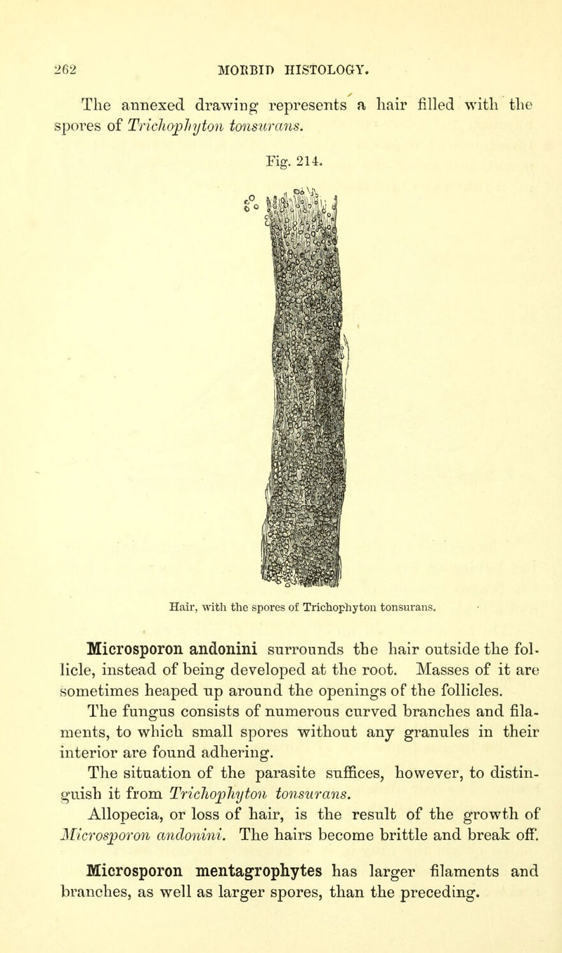 The annexed drawing represents a liair filled witli the spores of Trichophyton tonsurcms. Fig. 214. Hair, with the spores of Trichophyton tonsurans. Microsporon andonini surrounds the hair outside the fol- licle, instead of being developed at the root. Masses of it are sometimes heaped up around the openings of the follicles. The fungus consists of numerous curved branches and fila- ments, to v^hich small spores without any granules in their interior are found adhering. The situation of the parasite suffices, however, to distin- guish it from Tricliopliyton tonsurans. Allopecia, or loss of hair, is the result of the growth of Microsporon andonini. The hairs become brittle and break off. Microsporon mentagrophytes has larger filaments and branches, as well as larger spores, than the preceding.