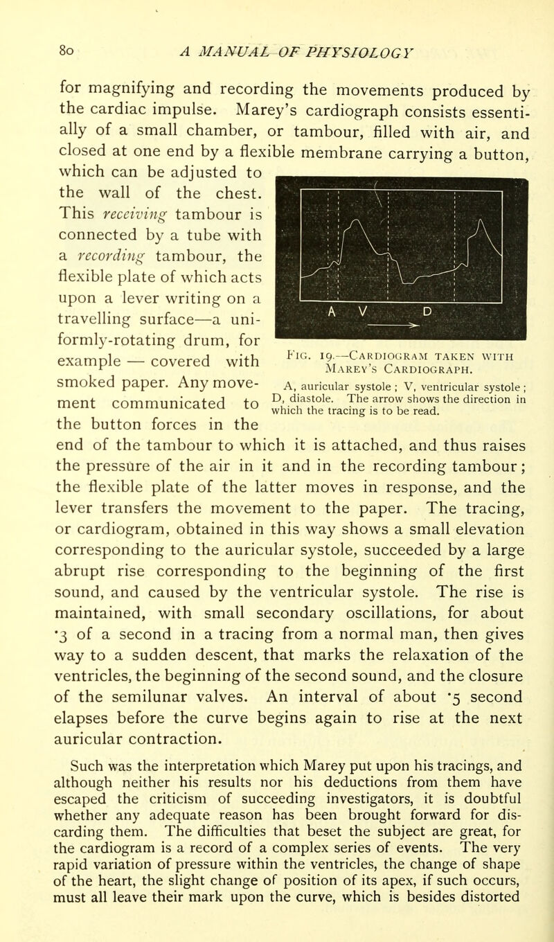 Fig. 19.—Cardiogram taken with Marey's Cardiograph. A, auricular systole ; V, ventricular systole ; D, diastole. The arrow shows the direction in which the tracing is to be read. for magnifying and recording the movements produced by the cardiac impulse. Marey's cardiograph consists essenti- ally of a small chamber, or tambour, filled with air, and closed at one end by a flexible membrane carrying a button, which can be adjusted to the wall of the chest. This receiving tambour is connected by a tube with a recording tambour, the flexible plate of which acts upon a lever writing on a travelling surface—a uni- formly-rotating drum, for example — covered with smoked paper. Any move- ment communicated to the button forces in the end of the tambour to which it is attached, and thus raises the pressure of the air in it and in the recording tambour; the flexible plate of the latter moves in response, and the lever transfers the movement to the paper. The tracing, or cardiogram, obtained in this way shows a small elevation corresponding to the auricular systole, succeeded by a large abrupt rise corresponding to the beginning of the first sound, and caused by the ventricular systole. The rise is maintained, with small secondary oscillations, for about •3 of a second in a tracing from a normal man, then gives way to a sudden descent, that marks the relaxation of the ventricles, the beginning of the second sound, and the closure of the semilunar valves. An interval of about '5 second elapses before the curve begins again to rise at the next auricular contraction. Such was the interpretation which Marey put upon his tracings, and although neither his results nor his deductions from them have escaped the criticism of succeeding investigators, it is doubtful whether any adequate reason has been brought forward for dis- carding them. The difficulties that beset the subject are great, for the cardiogram is a record of a complex series of events. The very rapid variation of pressure within the ventricles, the change of shape of the heart, the slight change of position of its apex, if such occurs, must all leave their mark upon the curve, which is besides distorted