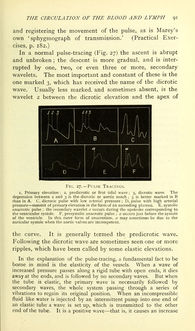 and registering the movement of the pulse, as is Marey's own ' sphygmograph of transmission.' (Practical Exer- cises, p. 182.) In a normal pulse-tracing (Fig. 27) the ascent is abrupt and unbroken ; the descent is more gradual, and is inter- rupted by one, two, or even three or more, secondary wavelets. The most important and constant of these is the one marked 3, which has received the name of the dicrotic wave. Usually less marked, and sometimes absent, is the wavelet 2 between the dicrotic elevation and the apex of P'iG. 27. —Pulse Tracings. I, Primary elevation ; 2, predicrotic or first lidal wave ; 3, dicrotic wave. The depression between 2 and 3 is the dicrotic or aortic notch ; 3 is better marked in B than in A. C, dicrotic pulse with low arterial pressure ; D, pulse with high arterial pressure—summit of primary elevation in the form of an ascending plateau. E, systolic anacrotic pulse ; the secondary wavelet a occurs during the upstroke corresponding to the ventricular systole. F, presystolic anacrotic pulse ; a occurs just before the systole of the ventricle. In this rarer form of anacrotism, a may sometimes be due to the auricular systole when the aortic valves are incompetent. the curve. It is generally termed the predicrotic wave. Following the dicrotic wave are sometimes seen one or more ripples, which have been called by some elastic elevations. In the explanation of the pulse-tracing, a fundamental fact to be borne in mind is the elasticity of the vessels. When a wave of increased pressure passes along a rigid tube with open ends, it dies away at the ends, and is followed by no secondary waves. But when the tube is elastic, the primary wave is necessarily followed by secondary waves, the whole system passing through a series of vibrations to regain its original position. When an incompressible fluid like water is injected by an intermittent pump into one end of an elastic tube a wave is set up, which is transmitted to the other end of the tube. It is a positive wave—that is, it causes an increase