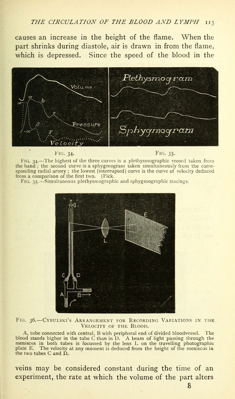 causes an increase in the height of the flame. When the part shrinks during diastole, air is drawn in from the flame, which is depressed. Since the speed of the blood in the KiG. 34.—The liighest of ihe three curves is a plethysmographic record taken from the hand ; the second curve is a sphygmograni taken simultaneously from the corre- sponding radial artery ; the lowest (interrupted) curve is the curve of velocity deduced from a comparison of the first two. (Fick. Fig. 35.—Simultaneous plethysmographic and sphygmographic tracings. Fk;. 36.—Cybulski's Arraxcjement for Recording Variations in the Velocity of the Blood. A, tube connected with central, B with peripheral end of divided bloodvessel. The blood stands higher in the tube C than in D. A beam of light passing through the meniscus in both tubes is focussed by the lens L on the travelling photographic plate E. The velocity at any moment is deduced from the height of the meniscus in the two tubes C and D. Fig. 34. Fig. 35. veins may be considered constant during the time of an experiment, the rate at which the volume of the part alters 8