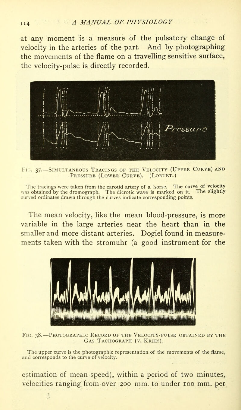 at any moment is a measure of the pulsatory change of velocity in the arteries of the part. And by photographing the movements of the flame on a travelling sensitive surface, the velocity-pulse is directly recorded. Fk;. 37.—Simultaneous Tracings of the Velocity (Upper Curve) and Pressure (Lower Curve). (Lortet.) Tlie tracings were taken from the carotid artery of a horse. The curve of velocity was obtained by the dromograph. The dicrotic wave is marked on it. The slightly curved ordinates drawn through the curves indicate corresponding points. The mean velocity, like the mean blood-pressure, is more variable in the large arteries near the heart than in the smaller and more distant arteries. Dogiel found in measure- ments taken with the stromuhr (a good instrument for the Fig. 38.—Photographic Record of the Velocity-pulse obtained by the Gas Tachograph (v. Kries). The upper curve is the photographic representation of the movements of the flame, and corresponds to the curve of velocity. estimation of mean speed), within a period of two minutes, velocities ranging from over 200 mm. to under 100 mm. per